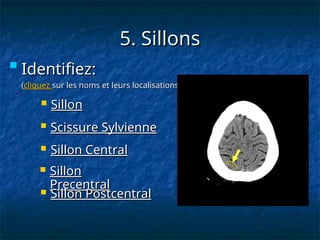 5. Sillons
5. Sillons
 Sillon Central
Sillon Central
 Sillon
Sillon
Precentral
Precentral
 Sillon
Sillon
 Scissure Sylvienne
Scissure Sylvienne
 Sillon Postcentral
Sillon Postcentral

Identifiez:
Identifiez:
(
(cliquez
cliquez sur les noms et leurs localisations)
sur les noms et leurs localisations)
 