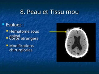 8. Peau et Tissu mou
8. Peau et Tissu mou
 Evaluez :
Evaluez :
 Modifications
Modifications
chirurgicales
chirurgicales
 Hématome sous
Hématome sous
galéal
galéal
 Corps etrangers
Corps etrangers
 