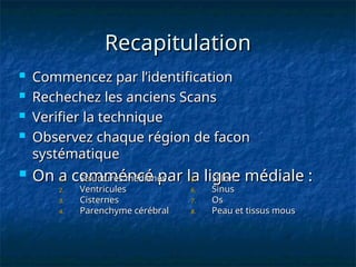 Recapitulation
Recapitulation
 Commencez par l’identification
Commencez par l’identification
 Rechechez les anciens Scans
Rechechez les anciens Scans
 Verifier la technique
Verifier la technique
 Observez chaque région de facon
Observez chaque région de facon
systématique
systématique
 On a comméncé par la ligne médiale :
On a comméncé par la ligne médiale :
1.
1. Structures médianes
Structures médianes
2.
2. Ventricules
Ventricules
3.
3. Cisternes
Cisternes
4.
4. Parenchyme cérébral
Parenchyme cérébral
5.
5. Sillon
Sillon
6.
6. Sinus
Sinus
7.
7. Os
Os
8.
8. Peau et tissus mous
Peau et tissus mous
 