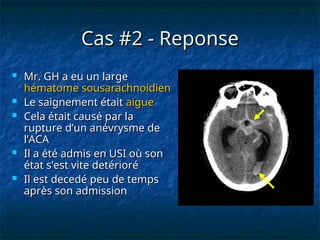 Cas #2 - Reponse
Cas #2 - Reponse
 Mr. GH a eu un large
Mr. GH a eu un large
hématome sousarachnoidien
hématome sousarachnoidien
 Le saignement était
Le saignement était aigue
aigue
 Cela était causé par la
Cela était causé par la
rupture d’un anévrysme de
rupture d’un anévrysme de
l’ACA
l’ACA
 Il a été admis en USI où son
Il a été admis en USI où son
état s’est vite detérioré
état s’est vite detérioré
 Il est decedé peu de temps
Il est decedé peu de temps
après son admission
après son admission
 