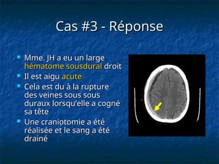 Cas #3 - Réponse
Cas #3 - Réponse
 Mme. JH a eu un large
Mme. JH a eu un large
hématome sousdural
hématome sousdural droit
droit
 Il est aigu
Il est aigu acute
acute
 Cela est du à la rupture
Cela est du à la rupture
des veines sous sous
des veines sous sous
duraux lorsqu’elle a cogné
duraux lorsqu’elle a cogné
sa tête
sa tête
 Une craniotomie a été
Une craniotomie a été
réalisée et le sang a été
réalisée et le sang a été
drainé
drainé
 