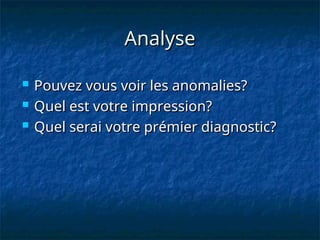 Analyse
Analyse
 Pouvez vous voir les anomalies?
Pouvez vous voir les anomalies?
 Quel est votre impression?
Quel est votre impression?
 Quel serai votre prémier diagnostic?
Quel serai votre prémier diagnostic?
 