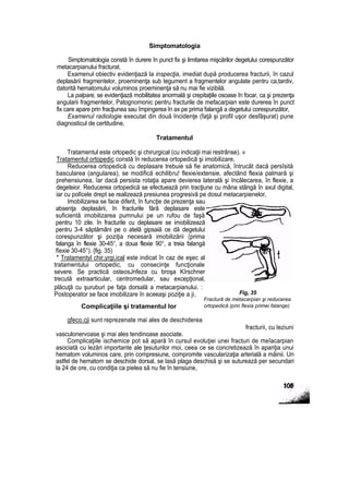 Simptomatologia
Simptomatologia constă în durere în punct fix şi limitarea mişcărilor degetului corespunzător
metacarpianului fracturat.
Examenul obiectiv evidenţiază la inspecţia, imediat după producerea fracturii, în cazul
deplasării fragmentelor, proeminenţa sub tegument a fragmentelor angulate pentru ca,tardiv,
datorită hematomului voluminos proeminenţa să nu mai fie vizibilă.
La palpare, se evidenţiază mobilitatea anormală şi crepitaţiile osoase în focar, ca şi prezenţa
angularii fragmentelor, Patognomonic pentru fracturile de mefacarpian este durerea în punct
fix care apare prin fracţiunea sau împingerea în ax pe prima falangă a degetului corespunzător,
Examenul radiologie executat din două Incidenţe (faţă şi profil uşor desfăşurat) pune
diagnosticul de certitudine,
Tratamentul
Tratamentul este ortopedic şi chirurgical (cu indicaţii mai restrânse). »
Tratamentul ortopedic constă în reducerea ortopedică şi imobilizare,
Reducerea ortopedică cu deplasare trebuie să fie anatomică, întrucât dacă persîsită
bascularea (angularea), se modifică echilibru! flexie/extensie, afectând flexia palmară şi
prehensiunea, îar dacă persista rotaţia apare devierea laterală şi încălecarea, în flexie, a
degeteior. Reducerea ortopedică se efectuează prin tracţiune cu mâna stângă în axul digital,
iar cu polîcele drept se realizează presiunea progresivă pe dosul metacarpienelor,
Imobilizarea se face diferit, în funcţie de prezenţa sau
absenţa deplasării, în fracturile fără deplasare este
suficientă imobilizarea pumnului pe un rufou de faşă
pentru 10 zile. în fracturile cu deplasare se imobilizează
pentru 3-4 săptămâni pe o atelă gipsaiă ce dă degetului
corespunzător şi poziţia necesară imobilizării (prima
falanga în flexie 30-45°, a doua flexie 90°, a treia falangă
fîexie 30-45°). {fig. 35)
* Tratamentyl chir,yrgi,ical este indicat în caz de eşec al
tratamentului ortopedic, cu consecinţe funcţionale
severe. Se practică osteosJnfeza cu broşa Kîrschner
trecută extraarticular, centromedular, sau excepţional,
plăcuţă cu şuruburi pe faţa dorsală a metacarpianului. :
Postoperator se face imobilizare în aceeaşi poziţie a ji,
Complicaţiile şi tratamentul lor
gfeco.cji sunt reprezenate mai ales de deschiderea
fracturii, cu leziuni
vasculonervoase şi mai ales tendinoase asociate.
Complicaţiile ischemice pot să apară în cursul evoluţiei unei fracturi de meîacarpian
asociată cu lezări importante ale ţesuturilor moi, ceea ce se concretizează în apariţia unui
hematom voluminos care, prin compresiune, compromite vascularizaţia arterială a mâinii. Un
astfel de hematom se deschide dorsal, se lasă plaga deschisă şi se suturează per secundari
la 24 de ore, cu condiţia ca pielea să nu fie în tensiune,
Fig, 35
Fractură de metacarpian şi reducerea
ortopedică (prin flexia primei falange)
 