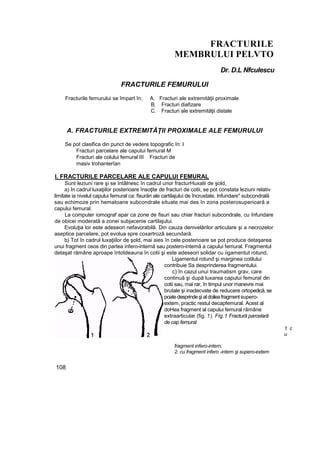 FRACTURILE
MEMBRULUI PELVTO
Dr. D.L Nfculescu
FRACTURILE FEMURULUI
Fracturile femurului se împart în: A. Fracturi ale extremităţii proximale
B, Fracturi diafizare
C. Fracturi ale extremităţii distale
A. FRACTURILE EXTREMITĂŢII PROXIMALE ALE FEMURULUI
Se pot clasifica din punct de vedere topografic în: l
Fracturi parcelare ale capului femural M
Fracturi ale colului femural III Fracturi de
masiv trohanterîan
I. FRACTURILE PARCELARE ALE CAPULUI FEMURAL
Sunt leziuni rare şi se întâlnesc în cadrul unor fracturHuxalii de şold,
a) In cadrul luxaţiilor posterioare însoţite de fracturi de cotii, se pot constata leziuni relativ
limitate ia nivelul capului femural ca: fisurări ale cartilajului de încrustate, Infundare" subcondrală
sau echimoze prin hematoane subcondrale situate mai des în zona posterosuperioară a
capului femural.
La computer iomograf apar ca zone de fisuri sau chiar fracturi subcondrale, cu înfundare
de obicei moderată a zonei subjacenie cartilajului.
Evoluţia lor este adeseori nefavorabilă. Din cauza denivelărilor articulare şi a necrozelor
aseptice parcelare, pot evolua spre coxartrozâ secundară.
b) Tot în cadrul luxaţiilor de şold, mai aies în cele posterioare se pot produce detaşarea
unui fragment osos din partea infero-internă sau postero-intemă a capului femural. Fragmentul
detaşat rămâne aproape întotdeauna în cotii şi este adeseori solidar cu iigamentut rotund,
Ligamentul rotund şi marginea cotilului
contribuie Sa desprinderea fragmentului.
c) în cazul unui traumatism grav, care
continuă şi după luxarea capului femural din
cotii sau, mai rar, în timpul unor manevre mai
brutale şi inadecvate de reducere ortopedică,se
poate desprindeşi al doileafragment supero-
extem, practic restul decapfemural. Acest al
doHea fragment al capului femural rămâne
extraarticular (fig. 1). Flg.1 Fractură parcelară
de cap femural
1. c
u
fragment infero-intern;
2. cu fragment infero -intern şi supero-extem
108
 