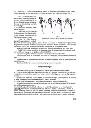 4; Clasificarea lui Garden care a luat drept criteriu de clasificare sistemu! trabecular ai colului.
£ Clasificarea face şi o bună apreciere prognostică. Autorul ie-a împărţit în 4 tipuri (fig, 5): '
•Tipul i - cuprinde fracturile
fncompteie şl fracturile prin abducje,
în ooxa valga din clasificarea lui
Bohler, Traveele osoase ale capului
femural sunt înclinate şi orientate
îtVuşorvaSgus,
r;
Au prognostic favorabil şi pot fi
tratate ortopedic,
•Tipul !l - fracturi complete dar
fără deplasare. Pe clişeul radio
grafie, traveele sunt rupte, dar îşi
păstrează direcţia normală,
• Tipul Iii. Sunt fracturi
pomplete cu deplasare parţială.
Sinoviala posterioare" şi repîiul pectineo-foveal (cu vasele ce îl străbat) menţin solidare
fragmentele fracturate, conferindu-le o oarecare stabilitate. Având asigurată o vascularizaţie
modestă a capului prin repiiul pactineo-foveal sunt şanse de evoluţie favorabilă.
Aspectul radiografie al traveeior osoase de la nivelul colului este de „arc frânt" gotic.
• Tipul IV. Sunt fracturi complete, cu deplasare totală, Sinoviata cotului femural este ruptă;
se reduc foarte greu şi au un grad mare de instabilitate.
Aspectul radiografie al traveeior osoase este de paralelism dar decalate.
Având un grad mare de instabilitate, reducerea se obţine greu, iar consolidarea este foarte
rară.
Odată cu ruperea sinovialei se produce şi ruperea principalelor surse de vase nutritive ale
capului femural.
Clasificare lui Garden are un mare interes prognostic şi terapeutic.
Simptomatologie
Semnele unei fracturi de co! femural sunt diferite după gradul lor de deplasare:
a) In fracturile incomplete sau angrenate, semnele sunt discrete. Impotenţa funcţională este
moderată, membrul inferior este într-o uşoară rotaţie externă pe care bolnavul şi-o poate
corecta.
Durerea este moderată, situată la baza triunghiului tui Scarpa. Este amplificată de paîpare
la acest nivel sau prin mobilizarea membrului inferior respectiv.
b) în fracturile complete de col femural simptomatologia este mai zgomotoasă.
§u,bjec|jy. Durerea este prezentă întotdeauna şi este amplificată de paîpare şi de tentativele
de mobilizare pasivă a şoldului,
Impotenţa funcţională este totală, bolnavul nu poate ridica călcâiul de pe planul patului.
QfalesMv, Primul lucru care se constată este atitudinea vicioasă a membrului inferior de
partea fracturii şi constă în: adducţie, rotaţie externă şi ascensionare a membrului inferior, i
inspecţie şi la paîpare se constată o proeminenţă ca o tumoare la baza triunghiului iui , Este
fragmentul distal al colului femural, care prin rotaţia externă proemsnă şi constituie Hui Laugier.
113
IV
Fig. S
Clasificarea fracturilor de coi femural după Garden
 