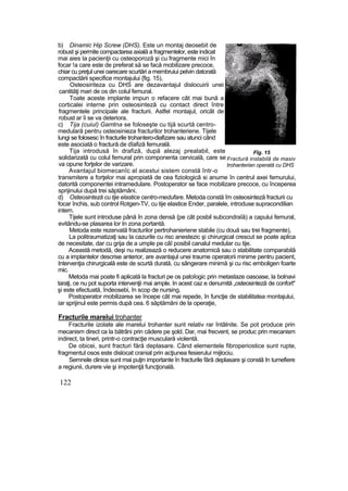 b) Dinamic Hip Screw (DHS). Este un montaj deosebit de
robust şi permite compactarea axială a fragmentelor, este indicat
mai aies Ia pacienţii cu osteoporoză şi cu fragmente mici în
focar !a care este de preferat să se facă mobilizare precoce,
chiar cu preţul unei oarecare scurtări a membruiui pelvin datorată
compactării specifice montajului {fig. 15),
Osteosiriteza cu DHS are dezavantajul dislocuirii unei
cantităţi mari de os din colul femural.
Toate aceste implante impun o refacere cât mai bună a
corticalei interne prin osteosinteză cu contact direct între
fragmentele principale ale fracturii. Astfel montajul, oricât de
robust ar îi se va deteriora.
c) Tija (cuiul) Gamtna se foloseşte cu tijă scurtă centro-
medulară pentru osteosinieza fracturilor trohanteriene. Tijele
lungi se folosesc în fracturile trohantero-diafizare sau atunci când
este asociată o fractură de dîafiză femurală.
Tija introdusă în drafiză, după alezaj prealabil, este
solidarizată cu colul femural prin componenta cervicală, care se
va opune forţelor de varizare.
Avantajul biomecanîc al acestui sistem constă într-o
transmitere a forţelor mai apropiată de cea fiziologică si anume în centrul axei femurului,
datorită componentei intramedulare. Postoperator se face mobilizare precoce, cu începerea
sprijinului după trei săptămâni.
d) Osteosinteză cu tije elastice centro-medufare. Metoda constă îm osteosinteză fracturii cu
focar închis, sub control Rotgen-TV, cu tije elastice Ender, paralele, introduse supracondilian
intern.
Tijele sunt introduse până în zona densă {pe cât posbil subcondraîă) a capului femural,
evitându-se plasarea lor In zona portantă.
Metoda este rezervată fracturilor pertrohanieriene stabile (cu două sau trei fragmente),
La politraumatizaţi sau la cazurile cu risc anestezic şi chirurgical crescut se poate aplica
de necesitate, dar cu grija de a umple pe câî posibil canalul medular cu tije.
Această metodă, deşi nu realizează o reducere anatomică sau o stabilitate comparabilă
cu a implantelor descrise anterior, are avantajul unei traume operatorii minime pentru pacient,
Intervenţia chirurgicală este de scurtă durată, cu sângerare minimă şi cu risc emboligen foarte
mic.
Metoda mai poate fi aplicată la fracturi pe os patoîogic prin metastaze oasoase, la bolnavi
taraţi, ce nu pot suporta intervenţii mai ample. In acest caz e denumită „osteosinteză de confort"
şi este efectuată, îndeosebi, în scop de nursing.
Postoperator mobilizarea se începe cât mai repede, în funcţie de stabilitatea montajului,
iar sprijinul este permis după cea. 6 săptămâni de la operaţie,
Fracturile marelui trohanter
Fracturile izolate ale marelui trohanter sunt relativ rar întâlnite. Se pot produce prin
mecanism direct ca la bătrâni prin cădere pe şold. Dar, mai frecvent, se produc prin mecanism
indirect, ta tineri, printr-o contracţie musculară violentă.
De obicei, sunt fracturi fără deplasare. Când elementele fibroperiostice sunt rupte,
fragmentul osos este dislocat cranial prin acţiunea fesierului mijlociu.
Semnele clinice sunt mai puţin importante în fracturile fără deplasare şi constă In tumefiere
a regiunii, durere vie şi impotenţă funcţională.
122
Fîg. 15
Fractură instabilă de masiv
trohanterian operată cu DHS
 