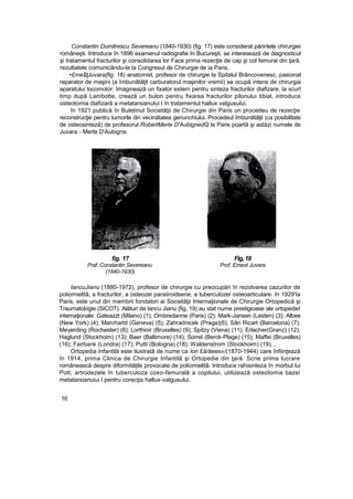 Constantin Dumitrescu Severeanu (1840-1930) (fig. 17) este considerat părintele chirurgiei
româneşti. Introduce în 1896 examenul radiografie în Bucureşti, se interesează de diagnosticul
şi tratamentul fracturilor şi consolidarea lor Face prima rezecţie de cap şi col femurai din ţară,
rezultatele comunicându-le la Congresul de Chirurgie de ia Paris,
•£rne$ţJuvara{fig. 18) anatomist, profesor de chirurgie la Spitalul Brâncovenesc, pasionat
reparator de maşini (a îmbunătăţit carburatorul maşinilor vremii) se ocupă intens de chirurgia
aparatului locomotor. Imaginează un fixator extern pentru sinteza fracturilor diafizare, la scurt
timp după Lambotte, crează un bulon pentru fixarea fracturilor pilonului tibial, introduce
osteotomia diafizară a metatarsianului l în tratamentul hallux valgusului.
în 1921 publică în Buletinul Societăţii de Chirurgie din Paris un procedeu de rezecţie
reconstrucţie pentru tumorile din vecinătatea genunchiului. Procedeul îmbunătăţit (ca posibilitate
de osteosinteză) de profesorul RobertMerle D'AubignedQ la Paris poartă şi astăzi numele de
Juvara - Merle D'Aubigne.
fig. 17 Fig,18
Praf. Constantin Severeanu Prof. Emest Juvara
(1840-1930)
tancuJianu (1880-1972), profesor de chirurgie cu preocupări în rezolvarea cazurilor de
poliomielită, a fracturilor, a osteozei paraiiroidsene, a tuberculozei osteoarticulare. In 1929'Ia
Paris, este unul din membrii fondatori ai Societăţii Internaţionale de Chirurgie Ortopedică şi
Traumatologie (SICOT). Alături de lancu Jianu {fig, 19) au stat nume prestigioase ale ortopedieî
internaţionale: Gateazzt (Milano) (1); Ombredanne (Paris) (2); Mark-Jansen (Leiden) (3); Albee
(New York) (4); Marchartd (Geneva) (5); Zahradnicek (Praga)(6); Sân Ricart (Barcelona) (7);
Meyerding (Rochester) (8); Lorthioir (Bruxelles) (9); Spitzy (Viena) (11); Erlacher(Granz) (12);
Haglund (Stockhoim) (13); Baer (Baltimore) (14); Sorrel (Berck-Plage) (15); Maffei (Bruxelles)
(16); Fairbank (Londra) (17); Putti (Bologna) (18); Waldenstrom (Stockhoim) (19), ,
Ortopedia Infantilă este ilustrată de nume ca Ion £ă/ăees«/(1870-1944) care înfiinţează
în 1914, prima Clinica de Chirurgie Infantilă şi Ortopedie din ţară. Scrie prima lucrare
românească despre diformităţile provocate de poliomielită. Introduce rahisinteza în morbul lui
Pott, artrodezele în tuberculoza coxo-femurală a copilului, utilizează osteotomia bazei
metatarsianuiui l pentru corecţia hallux-valgusului.
16
 