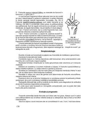 O Fracturile supra şi mteicon^UMne, au traiectele de fractură în
formă de V, Y (grec) sau T.
în mod frecvent fragmentul difizar pătrunde între cei doi condill
pe care îi dislocă lateral în partea lor superioară. In partea inferioară
ei rămân apropiaţi datorită ligamentelor încrucişate, (fîg. 20) D
Fracturile ţcjjafjZQ-metaiSzo-epifizare sunt relativ frecvente şi se
întâlnesc mai ales în accidentele rutiere grave; la poltiraumatizatj
sau polifracturaţi. Sunt de regulă cominutrve şi au cel puţin un traiect
intrarţicular, de regulă intercondilian. Se pot clasifica în două categorii:
• tip l - Fracturi cominutive, dar cu unele fragmente mari, care
pot permite refacerea anatomieie epifizei femurale;
* tip II - Fracturi cominulive, cu aspect de „explozie osoasă" la
care este aproape imposibil de refăcut anatomia femurului. La acest
tip de fractură este foarte grea refacerea axei şi lungimii femurului.
Q Fracturile unicoodillene de femur, de tip fractură - separaţie cu
fragmentul condilian ascensionat şi basculat superior.
O formă particulară de fractură unicondiliană constă în fracturarea
păr|H voiutate a condilului femural (fractura parcelara Hoffa) şl
ascensionarea discretă a fragmentului, dând aspectul radiologie de
radiografia de profil.
Simptomatologia
Fi0. 20
Fractură supra şf
intercondiliană de femur
cu dislocarea laterală a
condililor
„treaptă de scară", pe
Durerile vii locale sunt accentuate ia palpare sau încercările de mobilizare a genunchiului,
Impotenţa funcţională este totală.
Tumefactia regiunii cu mărirea diametrului atât transversal, cât şi anteroposterior este
însorită şi de o echimoză a regiunii poplitee.
Revărsatul lichidian intraarticular la nivelul genunchiului este voluminos şi în tensiune
moderată.
Adeseori se constată şi o scurtare moderată a coapsei, în fracturile supracondiliene şi
diafizo-metafizo-eplfizare, cu rotaţie externă a gambei şi piciorului.
Scurtarea se corectează In cea mai mare parte prin tracţiunea membrului Inferior în axul
său, dar se reface atunci când tracţiunea încetează.
Deviaţiile în vaîgus sau varus ale gambei sunt determinate de fracturile unicondîliene,
respectiv externe sau interne.
Examenul clinic se va termina întotdeauna cu cercetarea pulsului la pedioasâ şi tlbiala
posterioară, dar şi prin controlarea mobilităţii şt sensibilităţii piciorului.
Radiografia efectuată faţă, profil şi incidente de trei sferturi, pune diagnosticul de certitudine
şl permite încadrarea diagnostică şi terapeutică.
în unele cazuri este necesară şi o tomografie computerizată, care ne poate oferi date
foarte utile pentru tratament.
Evoluţie şi prognostic
Fracturile extremităţii disiale femurale sunt dintre cele mai grave. Adesori sunt în cadrul
unor politraumatisme sau Ia bolnavi vârstnici taraţi şl cu osteoporoză, fapt ce face şi mai dificil
tratamentul lor.
Dacă se obţine o bună reducere ele se consolidează în cea. 3 luni, însă bascularea
130
 