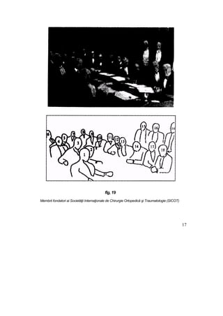 fîg, 19
Membrii fondatori ai Societăţii Internaţionale de Chirurgie Ortopedică şi Traumatologie (SICOT)
17
 