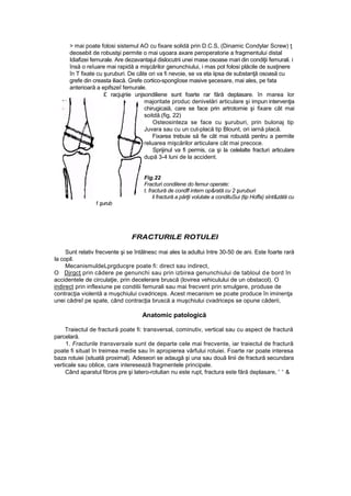 > mai poate folosi sistemul AO cu fixare solidă prin D.C.S, (Dinamic Condylar Screw) ţ
deosebit de robustşi permite o mai uşoara axare peroperatorie a fragmentului distal
Idiafizei femurale. Are dezavantajul dislocutrii unei mase osoase mari din condiţii femurali. i
însă o reîuare mai rapidă a mişcărilor genunchiului, i mas pot folosi plăcile de susţinere
în T fixate cu şuruburi. De câte ori va fi nevoie, se va eta iipsa de substanţă osoasă cu
grefe din creasta iliacă. Grefe cortico-spongîose masive şecesare, mai ales, pe fata
anterioară a epifszeî femurale.
£ racjujriie unjsondiliene sunt foarte rar fără deplasare. în marea lor
majoritate produc denivelări articulare şi impun intervenţia
chirugicaiă, care se face prin artrotomie şi fixare cât mai
soitdă.(fig, 22)
Osteosinteza se face cu şuruburi, prin bulonaj tip
Juvara sau cu un cut-placă tip Blount, ori iarnă placă.
Fixarea trebuie să fie cât mai robustă pentru a permite
reluarea mişcărilor articulare cât mai precoce.
Sprijinul va fi permis, ca şi la celelalte fracturi articulare
după 3-4 luni de la accident.
Fig.22
Fracturi condilene do femur operate:
t. fractură de condfl intern op&rată cu 2 şuruburi
li fractură a părţii volutate a condituSui (tip Hoffa) sînt&zătă cu
1 şurub
FRACTURILE ROTULEl
Sunt relativ frecvente şi se întâlnesc mai ales la adultui între 30-50 de ani. Este foarte rară
la copil.
MecanismuldeLprgducşre poate fi: direct sau indirect,
O Djrgcţ prin cădere pe genunchi sau prin izbirea genunchiului de tabloul de bord în
accidentele de circulaţie, prin decelerare bruscă (lovirea vehiculului de un obstacol). O
indirect prin inflexiune pe condilii femurali sau mai frecvent prin smulgere, produse de
contracţia violentă a muşchiului cvadriceps. Acest mecanism se poate produce în iminenţa
unei cădreî pe spate, când contracţia bruscă a muşchiului cvadriceps se opune căderii,
Anatomic patologică
Traiectul de fractură poate fi: transversal, cominutiv, vertical sau cu aspect de fractură
parcelară.
1. Fracturile transversale sunt de departe cele mai frecvente, iar traiectul de fractură
poate fi situat în treimea medie sau în apropierea vârfului rotuiei. Foarte rar poate interesa
baza rotuiei (situată proximal). Adeseori se adaugă şi una sau două linii de fractură secundara
verticale sau oblice, care interesează fragmentele principale.
Când aparatul fibros pre şi latero-rotulian nu este rupt, fractura este fără deplasare, ' ' &
 