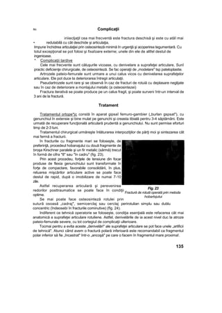 fiii: Complicaţii
iriiiecljaţil cea mai frecventă este fractura deschisă şi este cu atâî mai
• redutabilă cu cât deschide şi articulaţia,
Impune închidrea articulaţiei prin osteosinteză minimă în urgenţă şi acoperirea tegumentarâ. Cu
totul excepţional se pot folosi şi fixaîoare externe; unele din ele de altfel destul de
ingenioase.
* Complicaţii tardive
Cele mai frecvente sunt căluşurile vicoase, cu denivelare a suprafeţei articulare, Sunî
practic deficienţe chirurgicale, de osteosinteză. Se fac operaţii de „modelare" tsp pateloplastie.
Artrozele pateio-femurale sunt urmare a unui calus vicos cu denivelarea suprafeţelor
articulare. Ele pot duce la deteriorarea întregii articulaţii.
Pseudartrozele sunt rare şi se observă în caz de fracturi de rotuiă cu deplasare neglijate
sau în caz de deteriorare a montajului metalic {a osteosintezei)
Fractura iterativă se poate produce pe un calus fragil, şi poate surveni într-un interval de
3 ani de la fractură.
Tratament
Tratamentul ortope^jc constă în aparat gipsaî femuro-gambier („burlan gspsat"), cu
genunchiul în extensie şi bine mulat pe genunchi şi creasta tibială pentru 3-4 săptămâni. Este
urmată de recuperare funcţională articulară prudentă a genunchiului. Nu sunt permise eforturi
timp de 2-3 luni.
Tratamentul chirurgical urmăreşte înlăturarea interpozitjilor de părţi moi şi sintezarea cât
mai fermă a fracturii.
în fracturile cu fragmente mari se foloseşte, de
preferinţă, procedeul hobanajului cu două fragmente de
broşa Kirschner paralele şi un fir metalic (sârmă) trecut
în formă de cifra "8" sau "în cadru" (fig. 23).
Prin acest procedeu, forţele de tensiune din focar
produse de flexia genunchiului sunt transformate în
forţe de compactare, favorabile consolidării, în plus,
reluarea mişcărilor articulare active se poate face
destul de rapid, după o imobilizare de numai 7-10
zile.
Astfel recuperarea articulară şi perevenirea
redorilor posttraumatice se poate face în condiţii
optime.
Se mai poate face osteosinteză rotulei prin
sutură osoasă „cadraj", semicerclaj sau cerclaj perirotulian simplu sau dublu
concentric (îndeosebi în fracturile cominutive) (fîg. 24).
Indiferent ce tehnică operatorie se foloseşte, condiţia esenţială este refacerea cât mai
anatomică a suprafeţei articulare rotuliene. Astfel, denivelările de ia acest nivel duc la atroze
pateio-femurale severe, cu tot cortegiul de complicaţii ulterioare.
Tocmai pentru a evita aceste „denivelări" ale suprafeţei articulare se pot face unele „artificii
de tehnică". Atunci când avem o fractură polară inferioară este recomandabil ca fragmentul
polar inferior să fie „încastrat" într-o „ancoşă" pe care o facem în fragmentul mare proxima!.
135
Fig. 23
Fractură de rotuiă operată prin metoda
hobartsjutui
 