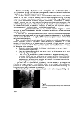 Poate surveni însă şi o deplasare medială a asiragalului, deci o fractură bimaleolară cu
subluxaţie internă, leziune muit mai gravă, deoarece implică şi leziuni lîgamentare şi capsuiare
importante care necesită un tratament mai complex.
în caz că traumatismul continuă şi după provocarea fracturii bimaleolare, astrgalul are
tendinţa de a se aşeza transversal, apasă pe marginea posterioară a pilonului tibiai, provocând
fracturarea acestuia, în acest caz, va rezulta o fractură bimaleolară şi marginală posterioară
sau o fractură „trimaleolară" (asimilând marginea posterioară a pilonului tibiat cu o a treia
maleolă). Leziunea este mult mai gravă, fiind însoţită de rupturi ligamentare şi capsuîare. Ele
pot fi evidenţiate adeseori prin radiografii simple, de faţă şi profil; uneori este însă nevoie de
un examen radiografie în poziţie forţată, provocată de medic sau prin încărcarea piciorului
(apăsarea pe picior), bineînţeles, după o prealabilă anestezie locală,
, piciorul basculează în jurul unui ax antero-posterior; marginea sa externă
se ridică, iar planta priveşte extern, aproape întotdeauna se asociază şi o oarecare rotaţie
externă a piciorului,
în prima fază va fi întins ligamentul colateral intern (deltoian) care se poate rupe parţial
sau total (ducând la diferite grade de entorsă), dar în marea majoritate a cazurilor se fracturează
maleola internă, detaşându-se de regulă, vârful. In acest caz apare o fractură unîmaleolară,
de obicei cu mică deplasare.
Dacă traumatismul continuă, astragalul eliberat în partea sa medială, apasă pe maleola
externă provocând şi fractura personeului. Va rezulta o fractură bimaîeolară cu sau fără
deplasare. Fractura de peroneu se poate produce, în principiu, la trei nivele diferite şi în funcţie
de asocierea fracturii de maleolă tibala cu unul din cele trei moduri de fracturare a peroneului
pot rezulta trei leziuni deosebite.
a) Dacă peroneui se fracturează la nivelul bazei maleolei sale, se va numi fractură
bimaleolară tip Dupuytren joasă,
b) Când peroneui se fracturează mai sus, la cea. 7-8 cm de vârful maleolei, se va numi
fractură tip Dupuytren înaltă.
c) Când fractura de peroneu se produce la nivelul gâtului peronier (prin torsionarea
peroneului distal în jurul axei sale), se va numi fractură tip Maisonneuve. Ultimul tip
de fractură este important pentru că se poate asocia cu o leziune a nervului sciatic
popliteu extern, la nivelul gâtului peronier, fie imediat în momentul accidentului, fie
tardiv prin prinderea în calus a nervului.
După provocarea fracturii bimaleolare, în momentul torsionării peroneului, se poate produce
şi smulgerea marginii posterioare a pilonului tibiai, solidară cu peroneui prin puternicul ligament
posterior aS articulaţiei tibio-peroniere inferioare. Astfel apare fractura bimaleolară şi una
marginală posterioarâ (trimaleolară) prin eversiune.
Ea este însoţită cel mai adesea şi de o subluxaţie postero-extemă a piciorului (fig. 31),
Fig. 31
Fractură bimaleolară cu subluxaţie externă a
piciorului
160
 