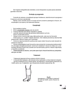 Dar imaginea radiograficâ este orientativă, numai intraoperator se poate aprecia adevărate
|gravitate e leziunilor,
Evoluţie şi prognostic
Fracturile de calcaneu consolidează aproape întotdeauna, datorită structurii spongioase •
8 osului şi a unei bune vascularizaţii,
Rămân uneori sechele severe în funcţie de forma anatomo-patologică a fracturii, de
complicaţiile ce pot apare şi de tratamentul efectuat.
Complicaţii
: Sunt imediate şi tardive,
l Dintre complicaţiile imediate este de amintit:
» Fractura deschisă care trebuie rezolvată în urgenţă;
* Leziunile vasculo-nervoase ale pachetului tibial posterior sunt rare.
Dintre complicaţiile tardivii:
* Căluşul vicios cu piciorul plat-valg şi lăţit posttraumatic, este cea mai frecventă.
Poate apare şi un „conflict" maleolo-calcanean, între maleola peronieră şt calcaneul lăţit
posttraumatic. Mersul şi statica pot fi dureroase,
* Sindromul algoneurodistrofic posttraumatic apare relativ frecvent şi este deosebit de
rezistent la tratament,
* Artroza subastragaliană este frecventă şi este produsă de incongruenţa posttraumaticâ
din articulaţia astragalocaicaneană. Uneori prin instalarea în decurs de câţiva ani a unei
anchiloze fibroase la acest nivel, durerile sunt mult diminuate şi permit o reluare mulţumitoare
a mişcărilor şi sprijinului.
* Osieita fistulizată de catcaneu, care poate apare după o fractură deschisă sau postoperalor,
este greu de tratat.
Tratament
Tratamentul depinde de forma anatomo-clinică a fracturii,
* în fracturile fără deplasare, atât articulare cât şi nearticulare, se face tratament ortopedic.
Se face imobilizarea într-un aparat gipsat, de preferinţă cu cameră liberă posterioară, tip
Graffin pentru cea. 6 săptămâni, apoi recuperarea articulară susţinută (fig. 36).
Fig.36
Aparatgipsat„cu camerăliberă posterioară"
de mers tip Graffin, pentru fractură de
caicaneu
 