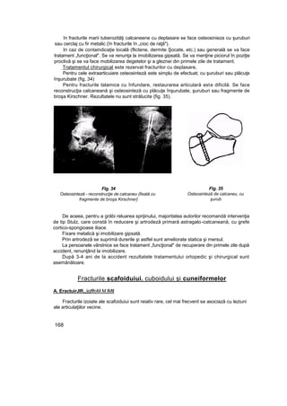 în fracturile marii tuberozităţi calcaneene cu deplasare se face osteosinieza cu şuruburi
sau cerclaj cu fir metalic (în fracturile în „cioc de raţă").
In caz de containdicaţie locală (flictene, dermite Şocate, etc.) sau generală se va face
tratament „funcţional". Se va renunţa la imobilizarea gipsată. Se va menţine piciorul în poziţie
proclivă şi se va face mobilizarea degetelor şi a gleznei din primele zile de tratament.
Tratamentul chirurgical este rezervat fracturilor cu deplasare,
Pentru cele extraarticuiare osteosinteză este simplu de efectuat; cu şuruburi sau plăcuţe
înşurubate (fig, 34)
Pentru fracturile talamice cu înfundare, restaurarea articulară este dificilă. Se face
reconstrucţia calcaneană şi osteosinteză cu plăcuţe înşurubate, şuruburi sau fragmente de
broşa Kirschner. Rezultatele nu sunt strălucite {fig. 35).
Fig. 34
Osteosinteză - reconstrucţie de catcaneu (fixată cu
fragmente de broşa Kirschner}
Fig. 35
Osteosinteză de calcaneu, cu
şurub
De aceea, pentru a grăbi reluarea sprijinului, majoritatea autorilor recomandă intervenţia
de tip Stulz, care constă în reducere şi artrodeză primară astragalo-catcaneană, cu grefe
cortico-spongioase iliace.
Fixare metalică şi imobilizare gipsată.
Prin artrodeză se suprimă durerile şi astfel sunt ameliorate statica şi mersul.
La persoanele vârstnice se face tratament „funcţional" de recuperare din primele zile după
accident, renunţând la imobilizare.
După 3-4 ani de la accident rezultatele tratamentului ortopedic şi chirurgical sunt
asemănătoare.
Fracturile scafoiduiui. cuboidului şi cuneiformelor
A. EractuirJIfi„„ijgflfoM.M.lMll
Fracturile izoiate ale scafoiduiui sunt reiativ rare, cel mai frecvent se asociază cu leziuni
ale articulaţiilor vecine.
168
 