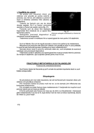j. fraglMrile de cuboîd
Se produc prin mecanism direct, prin
căderea unei greutăţi pe partea externă a
piciorului, sau mai rar, prin căderea cu piciorul în
equin şi zdrobirea cuboidului între calcaneu şi
metatrsiene.
Traiectul de fractură unic are de obicei
direcţie sagitală. Pot fi şi fracturi cominutive
asociate cu fracturi ale oaselor vecine {fig. 37).
Fracturile sunt de obicei fără deplasare,
fragmentele fiind menţinute de un aparat fibro-
ligamentar puternic.
Radiografia precizază diagnosticul şi
orientează conduita terapeutică.
Tratamentul constă în imobilizare într-un aparat gipsat de mers pentru 5-8 săptămâni.
Sunt rar Mâinile. Ele sunt de regulă asociate cu leziuni de scafoid şi de metatarsiene.
Mecanismul de producere este direct prin căderea unei greutăţi pe picior în zona pretibială,
în acest fel este fracturată aproape întotdeauna şi baza metatarsianului l.
Semnele clinice: dureri în punct fix, echimoză, edem eic,, sunt completate de examenul
radiologie care precizează diagnosticul.
Tratamentul constă în aplicarea unui aparat gipsat bine muiat pe arcada internă a piciorului.
Se menţine 6 săptămâni, apoi susţinător plantar pentru încă 4-5 luni.
FRACTURILE METATARSULUI Şl FALANGELOR
Fracturile metatarsîenelor
Sunt fracturi destul de frecvente şi pot fi urmate de sechele importante dacă nu sunt
tratate corespunzător.
Etîopatogenie
Se pot produce prin mai multe mecanisme, dar cel mai frecvent prin mecanism direct, prin
căderea unei greutăţi pe antepicior.
Prin mecanism indirect se produc mult mai rar, ca de exemplu prin inflexiunea sau
torsionarea antepiciorului.
Prin smulgere se poate fractura baza metatarsianului V tracţionată de muşchiul scurt
peronier iaterai,care se insera pe stiloidă.
O formă particulară este fractura de marş sau de efort a iui Deutshlander. interesează
gâtul metatarsienelor II şt mai rar III, după eforturi mari de mers ia indivizi neantrenaţi, descris
de militari ca „picior forţat".
170
Fig. 37
Dislocare astragalo-scafoidsariă cu fractură de
cuboid
 