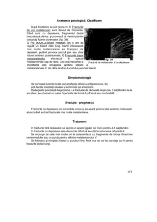 Anatomie patologică. Clasificare
După localizare se pot grupa în: O Fracturile
de coi metatarsian sunt destul de frecvente.
Când sunt cu depiasare, fragmentul dsstal
basculează plantar, şi provoacă la nivelul plantei
calozităţi foarte dureroase (fig. 38).
Q Fra_cturJle„„d,iafJzei metatars ien e are de
regulă un traiect oblic lung. Când interesează
mai multe metatarsiene se însoţesc de
depiasări, putând provoca picorul plat sau chiar
rotund anterior, posttraumatic, Q Fracturile bazei
metatarsienelor afectează In special
metatarsîenele cap de rând. Cea mai frecventă şi
importantă este smulgerea apofizei stiloide a
metatarsianuiui V, de către tendonul scurtului peronier lateral.
Simptomatologia
Se constată durerile locale cu tumefacţie difuză a antepscioruiui. Se
pot decela crepitaţii osoase şi echimoze pe antepicior.
Radiografia precizazâ diagnosticul. La fracturile de oboseală după cea, 3 săptămâni de la
accident, se observă un calus hipertrofie de formă fuziformă sau romboidală.
Evoluţie - prognostic
Fracturile cu deplasare pot consolida vicios şi să apară piciorul plat anterior, îndeosebi
atunci când au fost fracturate mai multe metatarsiene.
Tratament
în fracturile fără depiasare se aplică un aparat gipsat de mers pentru 4-5 săptămâni.
în fracturile cu depiasare este destul de dificil să se obţină reducerea ortopedică.
Se recurge de cele mai multe ori la osteosinteza cu fragmente de broşa Kirschner
centromedular sau cu şurub pentru stiloida metatarsianuiui V.
Se folosesc şi miniplăci fixate cu şuruburi fine. Mult mai rar se fac cerclaje cu fir pentru
fracturile oblice lungi.
171
fig. 38
Fractură de metatarsian V cu deplasare
 
