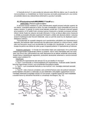 In fracturile de tip II, în care poziţia de reducere este dificil de obţinut, sau în cazurile de
nonconsolidare cu instabilitate se indică fuziunea cervicală posterioară prin unui dintre
procedeele clasice sau osteosinteza anterioară cu şuruburi canulate.
IV, EFracturairaumaticMMJMMMJ^i^isiuM sa u
afMXiSMtui (fractura spânzuraţilor)
în structura arcului vertebrei C2, pars interarticularis separă procesul articular superior de
ce! inferior, conectând pediculul cu lama. Ea este considerată o zonă vulnerabilă din punct de
vedere mecanic, în special, la nive!ul zonei laterale numită istrn. O fractură a istmului separă
arcul posterior a! C2 astfel încât, procesul spinos împreună cu lamele şi procesul articular
inferior rămân fixate de coloana cervicală inferioară, în timp ce blocul atlas-craniu împreună
cu dintele şi procesele articulare superioare formează o unitate care alunecă anterior. Leziunea
anaiomc^patologică este frecvent bilaterală, ceea ce permite acest tip de deplasare (spon-
dilolistezis anterior).
Traumatismele din această categorie sunt caracteristice solicitărilor prin hiperextensie şi
distraclie, fiind atribuite iniţial mecanismului de spânzurare judiciară (cu nodul an tenor). Astăzi
cele mai frecvente cauze sunt accidentele de circulaţie prin decelera|ie, în care craniul se
loveşte de parbriz sau bărbia de volan şi apoi ricoşează posterior în hiperextensie şi încărcare
Anatomie patologică ~ în funcţie de intensitatea forţei care acţionează, înir-o primă fază
cedează ligamentele longitudinale anterior şi posterior. Atunci când intensitatea este mai mare,
este rupt primul disc intervertebral sau este desinserat de pe plăcile vertebrale subcondrale.
Aceste lexiuni destabîlizază segmentul, producând alunecarea anterioară a cervico-craniuluî
peste corpul vertebrei C3.
Clasificare
Leziunile prin hiperextensie ale istmului C2 se pot clasifica în trei tipuri:
a. Tipul l - sunt fracturile cu minimă deplasare prin hiperextensie - încărcare axială. Datorită
leziunilor ligamentare minime, sunt considerate traumatisme stabile.
b. Tipul II ~ sunt considerate fracturile cu mai mult de 3 mm, translaţie anterioară asociată
cu anguîaţie.
c. Tipul III - este o leziune complexă, care combină fractura ceior doi pediculi extinsă la
nivelul faţetelor articulare cu dislocaţia uni sau bilaterală a articulaţiilor zygapofîzare C2-C3.
Translaţia anterioară şi angulaţia corpului C2 sunt severe, sugerând gradul de mare instabilitate
a acestei leziuni şi asocierea frecventă cu complicaţii neurologice, (fig, 10)
188
r> L ..- A ^
npuii
 