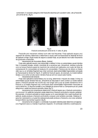 contondent, în această categoria intră fracturile deschise prin accident rutier, cât şi fracturile
prin armă de foc. (fig,5)
Fig.5
Fractură cominutivă prin armă de foc: A. alice; B. glonţ
Fracturile prin mecanism indirect sunt cele mai frecvente. Forja aplicată asupra unui
segment de membru determină o deformare a osului car© se fracturează la distanţă de locul
de aplicare a forţei. După modul de acţiune a acestor forje, se pot descrie mai multe mecanisme
de producere a fracturilor:
* mecanismul de încovoiere (flexie, îndoire)
Forţa este aplicată asupra unei extremităţi a diafizei în timp ce extremitatea opusă rămâne
fixă, în această situaţie, există o tendinţă de a accentua sau, dimpotrivă, redresa curburile
unui os lung şi fractura apare la maximum de curbură prin aplicarea unui cuplu de forje de
compresiune (în concavitate) şt tracţiune (în convexitate). Fractura are de obicei un traiect
oblic sau cu un al treilea fragment sau chiar cominutiv dacă extremităţile fragmentelor principale
se fracturează la rândul lor (fig.6). O astfel de fractură apare, de exemplu, la nivelul diafizei
tibiale a unui schior al cărui picior rămâne fixat pe schi iar corpul cade înainte;
* mecanismul de torsiune
Forţa este aplicată la extremitatea unui os lung, determină o mişcare de rotaţie, în timp ce
extremitatea opusă rămâne fixă sau, dimpotrivă se răsuceşte în sens contrar La nivelul diafrzei
apare o fractură spiroidă mai scurtă sau mai lungă care şi ea se poate transforma Intr-o
fractură cu al treilea fragment sau comînutivă dacă extremităţile fragmentelor fracturate se
rup la rândul lor. O răsucire brutală a unui fotbalist pe piciorul fixat cu crampoane pe sol, poate
determina o astfel de fractură spiroidă a tibiei (fîg.7),
* mecanismul de compresiune determină o fractură tasare sau o fractură cominutivă a
unui os scurt. Un astfel de mecanism poate determina o fractură cominutivă a corpului vertebral.
De exemplu, o lovitură verticală la nivelul capului ca In cazul plonjării într-o apă insuficient de
adâncă, poate produce o fractură comînutivâ a corpului unei vertebre cervicale. Căderea în
şezut la o persoană cu un grad de osteoporoză poate produce o fractură a unui corp vertebral
toracal inferior sau lombar superior (fig.8).
* mecanismul de smulgere- o contracţie musculară violentă poate determina smulgerea
unui fragment osos cu inserţia muşchiului respectiv. O contracţie violentă a cvadricepsuîui
23
 