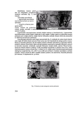 Stabilitatea inelului pelvin
ţine de integritatea complexului
posterior sacroiliac (fig. 1) care
include:
-articulaţia sacroiliacă;
- ligamentele sacroiliace,
sacroiuberozitare şi sacro-
spinoase;
- muşchii şi fascia pian-
şeului pelvin.
rioare, extrem de puternice,
menţin poziţia normală a osului
sacrum în petvis.
Ligamentele sacrospinoase rezistă rotaţiei externe a hemibazinului. Ligamentele
sacrotuberozitare rezistă forţelor rotaţionale în plan sagital. Forţele majore ce acţionează asupra
pelvisului sunt: rotaţia externă, rotaţia internă, forfecarea verticală, fiecare dintre ele producând
un diferit tip de fractură a pelvisului.
Vascularizaţia pelvisului este bogat reprezentată (fig. 2), alcătuită din artera iiiacă internă,
care naşte difi artera iliacă comună. Este sursa cea mai importantă de sânge pentru muscu-
latura şi viscerele pelvisului. Ba dă naştere anterior arterelor obturatorii şi ruşinoasa internă,
posterior artereior ilioiombară, latero-sacrală gluteala superioară şi giuteală inferioară, precum
şi ramurilor viscerale: ombilicală, veztcală inferioară, rectală medie, uterină. Plexul lombo-
sacral se întinde anterior şi lateraL O altă vecinătate importantă cu pelvisul osos sunt: uretra
membranoasă şi vezica urinară (fig. 2, cifrele 2 şi 3). Astfel uretra membranoasă perforează
diafragmul urogenital (frg. 2-A, cifra 1) şi se află sub simfiză în imediata vecinătate a simfizei
pubiene. Vezica urinară se află !n spatele oaselor pubiene. De asemenea, fracturile pelvisului
poî interesa, în deplasarea lor, şi rectul.
204
Fig. 2 Viscere şi vase sanguine vecine pelvisului
Fig, 1 (netulpelvin
 