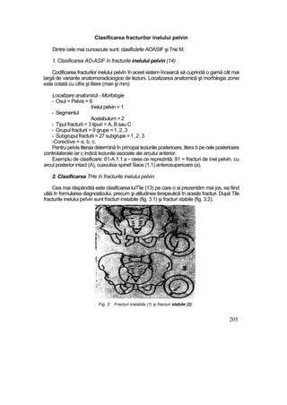 Clasificarea fracturilor inelului pelvin
Dintre cele mai cunoscute sunt: clasificările AOASIF şi Trie M.
1. Clasificarea AO-ASIF în fracturile inelului pelvin (14)
Codificarea fracturilor inelului pelvîn în acest sistem încearcă să cuprindă o gamă cât mai
largă de variante anatomoradioiogice de leziuni. Localizarea anatomică şt morfologia zonei
este cotată cu cifre şt litere (mari şi mm).
Localizare anatomică - Morfologie
- Osul = Pelvis = 6
Inelul pelvin = 1
- Segmentul
Acetabulum = 2
- Tipul fracturii = 3 tipuri = A, B sau C
- Grupul fracturii = 9 grupe =1,2,3
- Subgrupul fracturii = 27 subgrupe =1,2,3
-Corective = a, b, c.
Pentru peîvis literaa determină în principal leziunile posterioare, litera b pe cele posterioare
controlaterale iar c indică leziunile asociate ale arcului anterior.
Exemplu de clasificare: 61-A.1.1.a - ceea ce reprezintă: 81 = fracturi de inel pelvin, cu
arcul posterior intact (A), cuavulsia spinef îîiace (1.1) anterosuperioare (a).
2. Clasificarea THe în fracturile inelului pelvin
Cea mai răspândită este clasificarea luiTîie (13) pe care o si prezentăm mai jos, ea fiind
utiiă în formularea diagnosticului, precum şi atitudinea terapeutică în aceste fracturi. După Tile
fracturile inelului peîvin sunt fracturi instabile (fig. 3.1) şi fracturi stabile (fig. 3.2).
205
Fig. 3 Fracturi instabile (1) şi fracturi stabile (2)
 