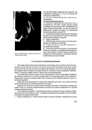 Flg, 9 Osteosinieza cu plăci şi şuruburi în
fracturile aripii îliace
2} Când diformitatea rotaţională este peste 30° sau
inegalitatea depăşeşte 1,5 cm va fi tratată prin
reducere şi osteosinteză,
d) Tipul C, trebuie tratat prin reducere şi
osteosinteză.
e) Fracturile deschise pelysne.
1} Fracturile deschise ale pelvisului dau o
mortalitate de 15%-50%. Seriile recente publică
mortalitatea de aproximativ 25%, Mortalitatea este
legată iniţial de hemoragie, iar apoi de sepsis si
deteriorarea multiplă de organe. 2J Tratamentul
fracturilor deschise de pelvis (13):
a) Controlul hemoragiei, adesea severă; pierderea
efectului de tamponadă prin fractura deschisă
exacerbează, pierderea sanguină;
b) Irigare şi debridare;
c) Anîibioterapie intravenoasă, incluzând gram-
negativi şi antibiotice pe anaerobi;
d) Fixator extern cu sau fără tracţiune în
traumatismele instabile;
e) Fracturile deschise de bazin cu traumatisme
rectale sau perineale, cu potenţialul contaminării prin
scaun de la plagă, trebuiesc tratate imediat prin
colostomie de drenaj pentru a minimaliza viitoarea
contaminare prin scaun (fecale).
Complicaţiile în fracturile pelvisului
* Hemoragia internă este gravă producând şoc hemoragie. Ea se produce prin focarul de
fractură cel mai frecvent şi doar în 2% dintre cazurile de hemoragie cauza este ruptura
vasculară. Dintre cei care mor prin traumatisme ale pelvisului, 4% au ca şi cauză hemoragia.
Ea necesită măsuri imediate de terapie intensivă, cu trasfuzii masive şi aplicarea fîxatorului
extern în fracturile instabile, pentru a efectua aşa numita tamponadă.
* Traumatismele uretrei şi vezicii urinare reprezintă 5% dintre complicaţiile însoţitoare
ale fracturilor peivisului (11). Dintre acestea peste 2/3 interesează ureîra. Ele se datoresc
fragmentelor osoase ce străbat pereţii vezicii urinare sau prin căderile călare pe o bară, cu
picioarele depărtate.
Diagnosticul se efectuează prin observarea sângerării prin penis, sau uretră (Ia femei),
echimoza perineaiâ. Se solicită pacientului să urineze.
Rupturile de uretră sau vezică urinară necesită intervenţia chirurgicală şi drenajul prin
cateter Foley (în rupturile intraperitoneale de vezică) sau bypass suprapubian (în rupturile
extrapersioneaie aie vezicii),
* Traumatismele intestinelor. Fragmentele de pelvis pot înţepa rectul sau intestinul subţire
când apar semne de abdomen acut, cu rigiditate peritoneală, ileus paralitic şi care necesită
intervenţia chirurgicală abdominală.
+ Ruptura diafragmului. Toate fracturile majore de pelvis necesită o radiografie de torace
209
 