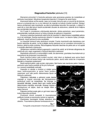 Diagnosticul fracturilor pelvisului (13)
Elementul primordia! în fracturile pelvisului este aprecierea gradului de instabilitate al
pelvisului traumatizat. Atitudinea terapeutică depinde în întregime de acest factor,
Anamneză trebuie să fte exactă, ceea ce te poate îndruma spre un anumit tip de leziune,
precum şi prezenţa sau nu a unui element de urgenţă ce trebuie imediat rezolvat. Desigur
natura accidentului este importantă, ea dând şl gravitatea leziunilor De exemplu, o cădere în
casă dă cu totul alte leziuni decât accidentele cauzate de atoturisme, căderile de la înălţime
sau accidentele industriale.
Vor fi luate în considerare urâmtoarele elemente: vârsta pacientului, sexul pacientului,
antecedentele medicale precum şi forţa şi direcţia de aplicare a impactului.
Examenul obiectivai pacientului este la fel de important în determinarea instabilităţii pelvine
ca şi cel radiologie. Esenţa examenului obiectiv în aceste cazuri, l-a descirs Apley: priveşte,
palpează, mişcă peîvisul şi scrie rezultatele.
La inspecţie bolnavul este dezbrăcat complet. Foarte importantă este depistarea unei
fracturi deschise de pelvis. La fel şi plăgile vecine pelvisului se vor considera comunicând cu
fractura, până la proba contrarie. Recunoaşterea fracturilor deschise de pelvis are un rol capital
în evoluţia ulterioară a bolnavului.
Sângerarea uretrală la bărbat sugerează o ruptură de uretră, iar la femeie sângerarea de
uretră sau prin vagin sugerează o fractură deschisă a pelvisului.
Deplasările pelvisului şi extremităţi/or arată, de asemenea, gravitatea traumatismului şi
mecanismul de producere a accidentului.
Dacă membrul pelvin este evident scurtat, rotat intern şi deplasat spre spina iliacă
posterioară, fără să existe fracturi ale membrului pelvin, atunci este vorba de o impactare
laterală cu impactare posterioare".
Dacă membrul pelvin, este scurtat, rotat extern, fără fracturi ale membrului pelvin, fractura
pelvisului este foarte posibilă să fie prin forfecare
cu o severă instabilitate verticală,
Inspecţia cu atenţie a nivelului şi rotaţiei spinei
iiiace anterosuperioare şi spinei iiiace postero-
superioare sunt utile pentru detreminarea tipului de
fractură a pelvisului.
Palpareacu delicateţe a pelvisului poate depista
crepitaţii şi mişcări anormale ale hemipelvisului:
amândouă indicii de instabilitate. Se împinge, cu
deosebită blândeţe, creasta iliacă spre medial pentru
determinarea mişcărilor anormale. Aceeaşi mişcare a
hemibazinuiui se obţine, dacă se roteşte intern şi
extern femurul.
Palparea simfizei poate găsi un gol mare ceea ce
Indică disjuncţîa simfizară.
Evaluarea clinică completă în traumatismele
peMsului include şi examinarea rectului şi vaginului
Examinarea neurologică încheie examenul clinic
obiectiv. Traumatismul plexului lombosacrat şi în
Fig. 7
Tomografia computerizată în fracturile pe/visului
207
 