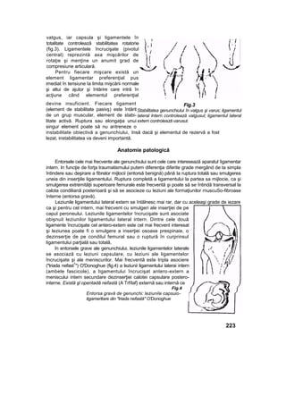 vatgus, iar capsula şi ligamentele în
totalitate controlează stabilitatea rotatorie
(fig.3). Ligamentele încrucişate (pivotul
central) reprezintă axa mişcărilor de
rotaţie şi menţine un anumit grad de
compresiune articulară.
Pentru fiecare mişcare există un
element ligamentar preferenţial pus
imediat în tensiune Ia limita mişcării normale
şi altui de ajutor şi întărire care intră în
acţiune când elementul preferenţial
devine insuficient. Fiecare ligament
(element de stabilitate pasivş) este întărit
de un grup muscular, element de stabi-
litate activă. Ruptura sau elongaţia unui
singur element poate să nu antreneze o
instabilitate obiectivă a genunchiului, Insă dacă şi elementul de rezervă a fost
lezat, instabilitatea va deveni importantă.
Anatomie patologică
Entorsele cele mai frecvente ale genunchiului sunt cele care interesează aparatul îigamentar
intern. In funcţie de forţa traumatismului putem diferenţia diferite grade mergând de ta simpla
întindere sau deşirare a fibrelor mijlocii (entorsă benignă) până Ia ruptura totală sau smulgerea
uneia din inserţiile ligamentului. Ruptura completă a ligamentului la partea sa mijlocie, ca şi
smulgerea extremităţii superioare femurale este frecventă şi poate să se întindă transversal la
calota condiliană posterioară şi să se asocieze cu leziuni ale formaţiunilor rnuscuSo-fibroase
Interne (entorsa gravă).
Leziunile ligamentului lateral extern se întâlnesc mai rar, dar cu aceleaşi grade de iezare
ca şi pentru cel intern, mai frecvent cu smulgeri ale inserţiei de pe
capul peroneului. Leziunile ligamentelor încrucişate sunt asociate
obişnuit leziunilor ligamentului lateral intern. Dintre cele două
ligamente încrucişate cel antero-extem este cel mai frecvent interesat
şi leziunea poate fi o smulgere a inserţiei osoase prespinaie, o
dezinserţie de pe condilul femural sau o ruptură în curprinsul
ligamentului parţială sau totală,
în entorsele grave ale genunchiului, leziunile ligamentelor laterale
se asociază cu leziuni capsulare, cu leziuni ale ligamentelor
încrucişate şi ale meniscurilor. Mai frecventă este tripla asociere
("triada nefast
1
") O'Donoghue (fig.4) a leziunii ligamentului laterai intern
(ambele fascicole), a ligamentului încrucişat antero-extern a
meniscului intern secundare dezinserţiei calotei capsulare postero-
interne. Există şl opentadă nefastă (A Trf/laf} externă sau internă ce
Fig.4
Entorsa gravă de genunchi: leziunile capsuio-
tigamerttare din "triada nefastă" O'Donoghue
223
Fig.3
Stabilitatea genunchiului în valgus şi varus; ligamentul
lateral Intern controlează valgusul; ligamentul lateral
extern controlează varusut.
 