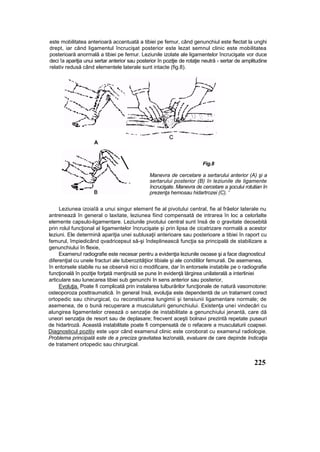 este mobilitatea anterioară accentuată a tibiei pe femur, când genunchiul este flectat la unghi
drept, iar când ligamentul încrucişat posterior este lezat semnul clinic este mobilitatea
posterioară anormală a tibiei pe femur. Leziunile izolate ale ligamentelor încrucişate vor duce
deci !a apariţia unui sertar anterior sau posterior în poziţie de rotaţie neutră - sertar de amplitudine
relativ redusă când elementele laterale sunt intacte (fig.8).
A
Fig.8
Manevra de cercetare a sertarului anterior (A) şi a
sertarului posterior (B) în leziunile de ligamente
încrucişate. Manevra de cercetare a şocului rotutian în
prezenţa hemosau hidartrozei (C). '
Leziunea izoiaîă a unui singur element fie al pivotului central, fie al frâelor laterale nu
antrenează în general o laxitate, leziunea fiind compensată de intrarea în loc a celorlalte
elemente capsulo-ligamentare. Leziunile pivotului central sunt însă de o gravitate deosebită
prin rolul funcţional al ligamentelor încrucişate şi prin lipsa de cicatrizare normală a acestor
leziuni. Ele determină apariţia unei subluxaţii anterioare sau posterioare a tibiei în raport cu
femurul, împiedicând qvadricepsut să-şi îndeplinească funcţia sa principală de stabilizare a
genunchiului în flexie,
Examenu! radiografie este necesar pentru a evidenţia leziunile osoase şi a face diagnosticul
diferenţial cu unele fracturi ale tuberozităţiior tibiale şi ale condililor femurali. De asemenea,
în entorsele stabile nu se observă nici o modificare, dar în entorsele instabile pe o radiografie
funcţională în poziţie forţată menţinută se pune In evidenţă lărgirea unilaterală a interliniei
articulare sau lunecarea tibiei sub genunchi In sens anterior sau posterior,
Evoluţia. Poate fi complicată prin instalarea tulburărilor funcţionale de natură vasomotorie:
osteoporoza posttraumatică. în general însă, evoluţia este dependentă de un tratament corect
ortopedic sau chirurgical, cu reconstituirea lungimii şi tensiunii ligamentare normale; de
asemenea, de o bună recuperare a musculaturii genunchiului. Existenţa unei vindecări cu
alungirea ligamentelor creează o senzaţie de instabilitate a genunchiului jenantă, care dă
uneori senzaţia de resort sau de deplasare; frecvent aceşti bolnavi prezintă repetate puseuri
de hidartroză. Această instabilitate poate fi compensată de o refacere a musculaturii coapsei.
Diagnosticul pozitiv este uşor când examenul clinic este coroborat cu examenul radiologie.
Problema principală este de a preciza gravitatea lez/onală, evaluare de care depinde Indicaţia
de tratament ortopedic sau chirurgical.
225

 