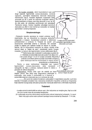 • de luxaţie completă, când traumatismul rupe pe
ângă capsulă, ligamentele coraco-clavieulare, conoid,
rapezoid,. permiţând deplasarea claviculei deasupra
iQomtonufui (fig.2). Această deplasare superioară este
avorizată pe de o parte de acţiunea muşchilor stemo-
îţeidomastoidian şi trapez care trag clavicula în sus, tar î0
de a!tă parte, de coborârea acromionului prin greutatea
Ttembruîui toracic. Centrul mişcărilor articulaţiei acromîo-
daviculare se aftâ în mod normal pe coracoidă, Ia inserţia
igamentskx
1
conoid şi trapezoid,
Simptomatologia
•'Subiectiv durerile spontane la nivelul umărului sunt
stipbrtabile, dar se intensifică ia mişcarea abductîe
exagerată a braţului. Accidentatul prezintă o deformare
psfraeteristică a umărului în "treaptă de scară", prin
ascensiunea extremităţii externe a claviculei. Din această
poziţie la palpare prin apăsare luxaţia se reduce în cazurile
latente, dar la întreruperea manevrei se reface. Acesta e^ste
semnul clasic ai "clapei de pian", caracteristic pentru fuxape
instabile, cu leziuni ale ligamentelor coraco-efâviculare (fig.3).
*''"' Deformarea este moderată în subluxaţse şi gradui de
.;••. rhbbiiitate al extremităţii claviculei poate fi de câţiva mm,
l dar poate atinge 1-2 cm în îuxaţia completă. Mişcările
umărului sunt libere până ta poziţia orizontală a braţului,
sjboi abducţia devine dureroasă în raport direct
proporţional cu amplitudinea.
Pentru a avea certitudinea integrităţii sau rupturii
ligamentelor coraco-claviculare, este necesară o
radiografie de faţă a umărului, bolnavul ţinând în mână o
greutate de câteva kilograme.
Diagnosticul. Pozitiv este uşor de stabilit pe baza
datelor clinice. Mai dificil este diagnosticul diferenţial în
subluxaţîe, care poate fi confundată cu o fractură a
extremităţii externe a claviculei sau cu o contuzie de umăr.
. Din punct de vedere funcţional, subluxaţiile în majoritatera cazurilor, sunt bine
tolerate, în luxaţiile complete însă, reducerea amplitudinii mişcărilor umărului şi micşorarea
forţei datorită incongruenţei articulare şi leziunilor meniscale determină o infirmitate importantă.
Tratament
-Luxaţia acromi'o-davfcufafă se reduce uşor, cfar reducerea se menţine greu, fapt ce a dat
sre unui număr mare de procedee terapeutice.
|îrr subluxaţie acrornto-claviculară recentă este indicat tratamentul ortopedic, în cazul
fielor mai puţin active este suficient bandajul toraco-brahiali tip Dessault - 7-14 zile,
288
Fig.2
Luxaţie ac/umio-ciaviculară
(completă): ligam&nt&ie coraco-
cfeviculare sunt rupte.
Fig.3
Reductibtfitatea deformatei:
semnul "etapei de pian"
 