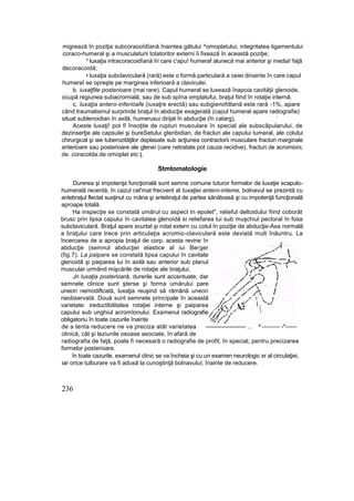 migrează în poziţia subcoraooîdîană înaintea gâtului ^omoplatului; integritatea ligamentului
coraco-humeral şi a musculaturii totatoritor externi îi fixează în această poziţie;
* luxaţia intracoracoidîană îri care c'apu! humeraf alunecă mai anterior şi media! faţă
decoracoidă;
• luxaţia subclaviculară (rară) este o formă particulară a ceiei dinainte în care capul
humeraî se opreşte pe marginea inferioară a claviculei.
b. iuxaţfite posterioare (mai rare). Capul humeral se luxează înapoia cavităţii glenoide,
ocupă regiunea subacromială, sau de sub spîna omplatufui, braţul fiind în rotaţie internă.
c. luxaţia antero-inferioafe (iuxaţre erectă) sau subgienofdtană este rară -1%, apare
când traumatismul surprinde braţul în abducţie exagerată (capul humeral apare radiografie)
situat sublenoidian în axilă, humerusui dirijat în abducţie (în catarg),
;
Aceste luxaţi! pot fi însoţite de rupturi musculare în special ale subscâpularului, de
dezinserţie ale capsulei şi bureSetului gtenbidian, de fracluri ale capului tumeral, ale colului
chirurgical şi aie tuberozităţilor deplasate sub acţiunea contractorii musculare fracturi marginale
anterioare sau posterioare ale glenei (care netratate pot cauza recidive), fracturi de acromioni,
de. coracotda.de omoplat etc.ţ.
Stmtomatologie
Durerea şi impotenţa funcţională sunt semne comune tuturor formelor de luxaţie scapulo-
humerală recentă, în cazul cel'mat frecvent al tuxaţiei antero-inteme, bolnavul se prezintă cu
antebraţul flectat susţinut cu mâna şi antebraţul de partea sănătoasă şi cu impotenţă funcţională
aproape totală.
Ha inspecţie se constată umărul cu aspect In epolet", relieful deltoidului fiind coborât
brusc prin lipsa capului în cavitatea glenoidă si reliefarea lui sub muşchiul pectoral în fosa
subclaviculară. Braţul apare scurtat şi rotat extern cu cotul în poziţie de abducţie-Axa normală
a braţului care trece prin articulaţia acromio-claviculară este deviată mult înăuntru. La
încercarea de a apropia braţul de corp, acesta revine în
abducţie (semnul abducţiei elastice al iui Berger
(fig.7). La palpare se constată lipsa capului în cavitate
glenoidâ şi paiparea lui în axilă sau anterior sub planul
muscular urmând mişcările de rotaţie ale braţului,
Jn luxaţia posterioară, durerile sunt accentuate, dar
semnele clinice sunt şterse şi forma umărului pare
uneori nemodiftcată, luxaţia reuşind să rămână uneori
neobservată. Două sunt semnele principale în această
varietate: ireductibilitatea rotaţiei interne şi paiparea
capului sub unghiul acromîonului. Examenul radiografie
obligatoriu în toate cazurile înainte
de a tenta reducere ne va preciza atât varietatea -------------------- ... ^ --------- -*——
clinică, cât şi leziunile osoase asociate, în afară de
radiografia de faţă, poate fi necesară o radiografie de profil, în special, pentru precizarea
formelor posterioare.
în toate cazurile, examenul clinic se va încheia şi cu un examen neurologic sr al circulaţiei,
iar orice tulburare va fi adusă la cunoştinţă bolnavului; înainte de reducere.
236

 
