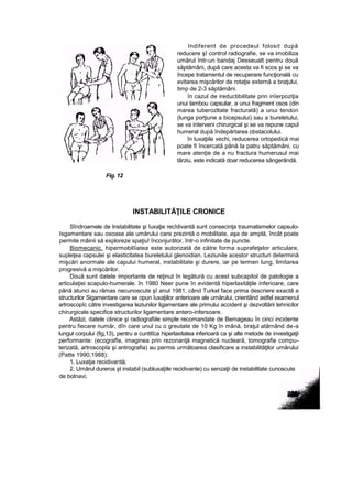 Indiferent de procedeul folosit după
reducere şî control radiografie, se va imobiliza
umărul într-un bandaj Desseualt pentru două
săptămâni, după care acesta va fi scos şi se va
începe tratamentul de recuperare funcţională cu
evitarea mişcărilor de rotaţie externă a braţului,
timp de 2-3 săptămâni.
în cazul de ireductibilitate prin inîerpoziţia
unui lambou capsular, a unui fragment osos (din
marea tuberozltate fracturată) a unui tendon
(lunga porţiune a bicepsului) sau a bureletului,
se va interveni chirurgical şi se va repune capul
humeral după îndepărtarea obstacolului.
în luxaţiile vechi, reducerea ortopedică mai
poate fi încercată până la patru săptămâni, cu
mare atenţie de a nu fractura humerusul mai
târziu, este indicată doar reducerea sângerândă.
Fig. 12
INSTABILITĂŢILE CRONICE
Sîndroamele de Instabilitate şi îuxaţie recîdivantă sunt consecinţa traumatismelor capsulo-
Isgamentare sau osoase ale umărului care prezintă o mobilitate, aşa de amplă, încât poate
permite mâinii să exploreze spaţiu! înconjurător, într-o infinitate de puncte.
Biomecanic. hipermobilîiatea este autorizată de către forma suprafeţelor articulare,
supleţea capsulei şi elasticitatea bureletului glenoidian. Leziunile acestor structuri determină
mişcări anormale ale capului humeral, instabilitate şi durere, iar pe termen lung, limitarea
progresivă a mişcărilor.
Două sunt datele importante de reţinut în legătură cu acest subcapitol de patologie a
articulaţiei scapulo-humerale. în 1980 Neer pune în evidentă hiperlaxităţile inferioare, care
până atunci au rămas necunoscute şî anul 1981, când Turkel face prima descriere exactă a
structurilor Sigamentare care se opun îuxaţiilor anterioare ale umărului, orientând astfel examenul
artroscopîc către investigarea leziunilor ligamentare ale primului accident şi dezvoltării tehnicilor
chirurgicale specifice structurilor ligamentare antero-infersoare.
Astăzi, datele clinice şi radiografiile simple recomandate de Bemageau în cinci incidente
pentru fiecare număr, dîn care unul cu o greutate de 10 Kg în mână, braţul atârnând de-a
lungul corpului (fig,13), pentru a cuntitîca hiperlaxitatea inferioară ca şi alte metode de investigaţii
performante: (ecografîe, imaginea prin rezonanţă magnetică nucleară, tomografie compu-
terizată, artroscopîa şi antrografia) au permis următoarea clasificare a instabilităţilor umărului
(Patte 1990,1988):
1, Luxaţia recidivantă;
2. Umărul dureros şt instabil (subluxaţiile recidivante) cu senzaţii de instabilitate cunoscute
de bolnavi;
 