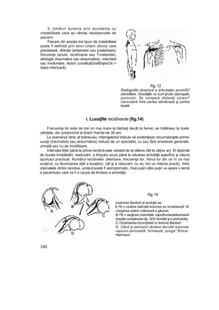 3, Umăru! dureros prin accidente cu
instabilitate care au rămas neobservate de
pacient
Fiecare din aceste trei tipuri de instabilitate
poate fi definită prin einci criterii clinice care
precizează, direcţia (anterioare sau posterioare),
frecvenţa (acute, recidivanie sau Tnveterate),
etiologia (traumatice sau atraumatice), voluntare
sau involuntare, factori constituţiQnafi(hipeî3x.~
tatea inferioară).
Fig. 13
Radiografie dinamică a articulaţiei acromÎQ"
clavicttlare. Greutăţile nu sunt ţinute ctacroşate,
pumnului. Se compară distanţa coraco^
clavicularâ între partea sănătoasă şi partea
lezată.
i. Luxaţîîle recidivante (fig.14)
Frecvenţa lor este de trei ori mai mare la bărbaţi decât la femei, se întâlnesc la toate
vârstele, dar predomină Ia tinerii înainte de 30 ani.
La examenul clinic al bolnavului, interogatoriul trebuie să evidenţieze circumstanţele primei
iuxaţii (traumatice sau atraumatice) redusă de un specialist, cu sau fără anestezie generală,
urmată sau nu de imobilizare,
Intervalul liber până la prima recidivă este variabil de ta câteva zile la câţiva ani. El depindă
de durata imobilizării, reeducării, a timpului scurs până la reluarea activităţii specifice şi natura
sportului practicat. Numărul recidivelor ulterioare, frecvenţa lor, ritmul lor din ce în ce mai
susţinut, cu favorizarea atât a luxaţiiior, cât şi a reducerii, nu au nici un interes practic, între
intervalele dintre recidive, umărul poate fi asimptomatic, însă puţin câte puţin va apare o temă
a pacientului care va fi o cauză de limitare a activităţii.
Fig, 14
Leziunea Bankart şi evoluţia sa;
A Pe o vedere laterală leziunea se localizează 1$
marginea antero inferioară a gleznei.
B. Pe o secţiune orizontală, caputhumeratdezinseră
inserţia complexului tig. GH)~burelet şi a periostulw,
C. Cicatrizarea incompletă cu leziune Bankart. l
D. Când şi periostul rămâne decolat leziunea
capsuio-periostală formează punga* Broca-
Hartmann,
240
 