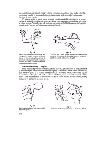 cu degetele înainte şi policele înapoi.Testui se efectuează accentuând încet rotaţia externă şi
retropuisia braţului, în timp ce policele mâinii aşezate pe umăr, exerdtă o împingere pe
humeral dinapoi-înainte.
Pe faţa bolnavului se citeşte teama care este imediat raportată la interogatoriu, iar uneori-
de teamă, subiectul nu mai permite examinatorului de a efectua manevra în particular, retropulst»;
şi rotaţia externă. Această manevră, poate de asemenea, să fie făcută cu pacientul în poziţie
culcată, este "fulcrum test" ai autorilor americani (fig.16).
fig. 15
Testul de aprehensiune:abducţie 90"
retropuisie, rotaţie externă. Policele
stâng sf examinatorului exercită o
presiune antero-posterioară a capului
humeral pe care o controlează degetele
plasate înaintea articulaţiei.
Fig, 1ff
"Fulcrum test". Mâna stângă a examinatorului aşezată,
sub umăr formează un braţ de pârghie pentru retropyisia 
cotului exercitată către mâna dreaptă.
Sertarul anteriorffiq.17-Hig.18).
Poate fi cercetat prin manevra Rodinau (1980), subiectul aplecat înainte, cu braţul atârnând
şi relaxat complet, sau manevra Rockwood {fig.18), Examinatorul plasat înapoi stabilizează;
cu o mână omopiatul şi cu cealaltă mână cercetează o mobilitate antero-posterioară a capului
numeral în raport cu gtena. Un sertar posterior este fiziologic; un sertar anterior când există,;
poate să se însoţească de un cracmoent sau de un resort. Pentru a avea valoare, testiftj
trebuie să fie comparat cu partea opusă.
Fig. 17
Cercetarea sertarului prin manevra lui
Radineau (1980)
Fig. 18
Cercetarea sertarului prin manevra lui Rockwood (1384),
242
 