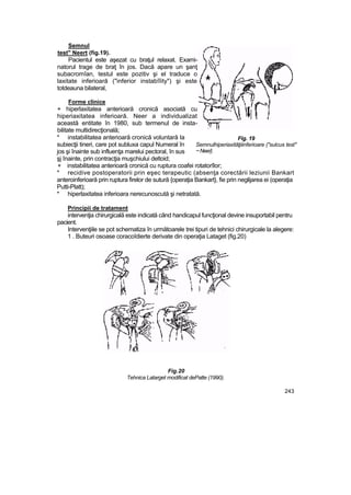 Semnul
test" Neert (fig.19).
Pacientul este aşezat cu braţul relaxat. Exami-
natorul trage de braţ în jos. Dacă apare un şanţ
subacromîan, testul este pozitiv şi el traduce o
laxitate inferioară ("inferior instabîîity") şi este
totdeauna bilateral,
Forme clinice
+ hiperlaxitatea anterioară cronică asociată cu
hiperiaxitatea inferioară. Neer a individualizat
această entitate în 1980, sub termenul de insta-
bilitate multidirecţională;
* instabilitatea anterioară cronică voluntară Ia
subiecţii tineri, care pot subluxa capul Numeral în
jos şi înainte sub influenţa marelui pectoral, în sus
şj înainte, prin contracţia muşchiului deltoid;
+ instabilitatea anterioară cronică cu ruptura coafei rotatorîlor;
* recidive postoperatorii prin eşec terapeutic (absenţa corectării leziunii Bankart
anteroinferioară prin ruptura firelor de sutură {operaţia Bankart}, fie prin neglijarea ei (operaţia
Putti-Platt);
* hiperlaxitatea inferioara nerecunoscută şi netratată.
Principii de tratament
intervenţia chirurgicală este indicată când handicapul funcţional devine insuportabil pentru
pacient.
Intervenţiile se pot schematiza în următoarele trei tipuri de tehnici chirurgicale la alegere:
1 . Buteuri osoase coracoîdierte derivate din operaţia Lataget (fig.20)
Fig.20
Tehnica Latarget modificat dePatte (1990).
243
Fig. 19
Semnulhiperiaxităţiiinferioare ("sulcus test"
~Neer}.
 