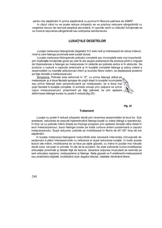 pentru trei săptămâni în prima săptămână cu pumnul în flexiune palmara de 4QM5".
In căzu! când nu se poate reduce ortopedic se va practica reducere sângerândă cu
creşterea riscuiui de necroză aseptică secundară, în cazurile vechi cu tulburări funcţionale se
va încerca repunerea sângerândă sau extirparea semilunarului.
LUXAŢ1ILE DEGETELOR
Luxaţia metacarpo-falangîanăa degetelor II-V este rară şi interesează de obicei indexul,
nivel ia care falanga proximaiă este luxată dorsal.
Luxaţia metacarpo'falangianăa policelui completă sau incompletă este mai importantă
prin implicaţiile funcţionale grave pe care fe are asupra prehensiunii.Se produce printr-o mişcare
de hîperextensie a falangei pe metacarpian în căderile pe policete extins si în abductie. Se
produce o ruptură a capsulei anterioare şi în luxaţiile complete falanga şi placa volară a
sesamoidelor cu inserţiile adductorului intern şi scurtului flexor extern, se deplasează posterior
pe faţa dorsală a metacarpianului.
Simptome. Policele este deformat în "Z", cu prima falangă oblică pe
metacarpian şi a doua flectată aproape de unghi drept în luxaţiile incomplete
sau prima falangă este perpendiculară pe metacarpian, iar a doua mai
puţin fiectată în luxaţiile complete. In ambele situaţii prin palpare se simîe
capul metacarpianuluî proeminent pe faţa palmară, iar prin apăsare
deformarea falangei luxate nu poate fi redusă ţfig.25).
Ffg. 25
Tratament
Luxaţia nu poate fi redusă ortopedic decât prin revenirea sesamoidelor la locul lor. Sub
anestezie, reducerea se execută hiperextinzând falanga luxată cu mâna stângă a operatorului,
în timp ce cu policele mâinii drepte se împinge progresiv prin apăsare dorsală către distal în
axul metacarpianuiui, baza falangei luxate pe toată curbura antero-posterioară a capului
metacarpianului. După reducere, policele se imobilizează în flexi'e de 45°-60° timp de trei
săptămâni.
în luxaţia metacarpo-falangiană ireductibilă este necesară intervenţia chirurgicală de
secţionare a plăcii intersesamoide cu refacerea ei după reducerea luxaţiei. în toate aceste
leziuni ale mâinii, imobilizarea se va face pe aţele gîpsate, cu mâna tn poziţie mai ridicată
decât cotul, cel puţin în primele 10 zile de la accident. Nu este suficientă numai imobilizarea
articulaţiei proximale şi distale faţă de leziune, deoarece acţiunea musculară se exercită pe
serii articulare carpiene, metacarpîene şi falange. Atela gipsaiă va fi antebranhi-metacarpiană
sau aniebrahio-dîgitală, imobilizând doar degetul afectat, celelalte rămânând libere.
248
 