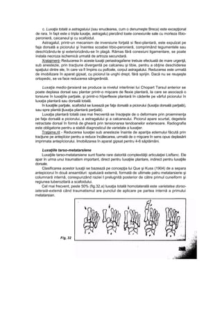 c. Luxaţia totală a astragaluiui (sau enuclearea, cum o denumeşte Breca) este excepţional
de rara. în fapt este o tripla luxaţie, astragalu) pierzând toate conexiunile sale cu morteza tîbio-
peronieră, caicaneul şi cu scafoidul.
Astragalul, printr-un mecanism de inversiune forţată si flexi-plantară, este expulzat pe
faja dorsală a piciorului şi înaintea scoabei tibio-peronieră, comprimând tegumentele sau
deschîzându-le şi exteriorizându-se în plagă. Rămas fără conexiuni ligamentare, se poate
instala necroza ischemică urmată de artroza secundară.
Xratajrnen|- Reducerea în aceste luxaţii periastragaîiene trebuie efectuată de mare urgenţă,
sub anestezie, prin tracţiune divergentă pe calcaneu şi tibie, pentru a obţine deschiderea
spaţiului dintre ele, în care va fi împins cu polîcele, corpul astragalului. Reducerea este urmată
de imobilizare în aparat gipsat, cu piciorul Ia unghi drept, fără sprijin. Dacă nu se reuşeşte
ortopedic, se va face reducerea sângerândă.
Luxaţia medio-ţarsiană se produce ia nivelul interliniei lui Chopart Tarsul anterior se
poate deplasa dorsal sau plantar printr-o mişcare de flexie plantară, la care se asociază o
torsiune în luxaţiiîe parţiale, şi printr-o hîperflexie plantară In căderile pe vârful piciorului în
luxaţia plantară sau dorsală totală.
în luxaţiile parţiale, scafoidul se luxează pe faţa dorsală a piciorului (luxaţia dorsală parţială),
sau spre plantă ţluxaţia plantară parţială).
Luxaţia plantară totală cea mai frecventă se însoţeşte de o deformare prin proeminenţa
pe faţa dorsală a piciorului, a astragalului şi a calcaneului. Piciorul apare scurtat, degeteîe
retractate dorsal în formă de gheară prin tensionarea tendoanelor extensoare. Radiografia
este obligatorie pentru a stabili diagnosticul de varietate a luxaţier.
Traţame,rit - Reducerea luxaţiei sub anestezie înainte de apariţia edemului făcută prin
tracţiune pe antepîcior pentru a reduce încălecarea, urmată de o mişcare în sens opus deplasării
imprimata antepîciorului. Imobilizarea în aparat gipsat pentru 4-6 săptămâni.
Luxaţiile tarso-metatarslene
Luxaţiile tarso-metatarsiene sunt foarte rare datorită complexităţii articulaţiei Lisftanc. Ele
apar In urma unui traumatism important, direct pentru îuxaţiiie plantare, indirect pentru luxaţiile
dorsale.
Clasificarea acestor luxaţii se bazează pe concepţia lui Que şi Kuss (1904) de a separa
antepiciorui în două ansambluri: spatuiară externă, formată de ultimele patru metatarsierie şi
columnară internă, corespunzând raziei l prelugnită posterior de către primul cuneiform şi
regiunea tuberozitară a scafoidului.
Cel rnai frecvent, peste 50% (fig.32.a) luxaţia totală homotaterală este varietatea dorso-
iateraiă-extemă când traumatismul are punctul de aplicare pe partea internă a primului
metatarsian.
F/g, 32
 