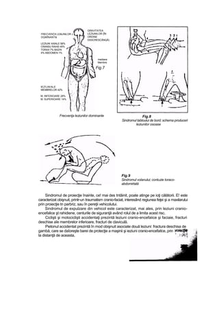 mediane
Membre
Fig.7
Frecvenţa leziunilor dominante Fig.8
Sindromul tabloului de bord; schema produceri
leziunilor osoase
Fig.9
Sindromul volanului; contuzie toraco-
abdomirtată
Sindromul de proiecţie înainte, ce! mai des tntâinit, poate atinge pe ioţi călătorii. E! este
caracterizat obişnuit, printr-un traumatism cranio-faciat, interesând regiunea feţei şi a maxilarului
prin proiecţie tn parbriz, sau în pereţii vehicolutui.
Sindromul de expulzare din vehicol este caracterizat, mai ales, prin leziuni cranio-
encefalice şt rahidiene, centurile de siguranţă având rolul de a limita acest risc.
Ciclişti şi motociclişti accidentaţi prezintă leziuni cranio-encefaiice şi faciaie, fracturi
deschise aîe membrelor inferioare, fracturi de claviculă.
Pietonul accidentat prezintă în mod obişnuit asociate două leziuni: fractura deschisa de
gambă, care se daîoreşte barei de protecţie a maşinii şi ieziuni cranio-encefaitce, prin
la distanţă de aceasta,
GRAVITATEA
LEZIUNILOR {ÎN
ORDINE
DSSCRESCÂNQĂ)
FRECVENŢA LE&UNiLOR J
DQMÎNANT&
LEZIUN! AXIALE 58%
CRANSU RAHiS 45%
TGRAX 7% BA2!N
4% ABDOMEN 1%
tEZ!LIN!ALE
MEMBRELOR 42%
M, INFERIOARE 28%
M. SUPERIOARE 14%
 