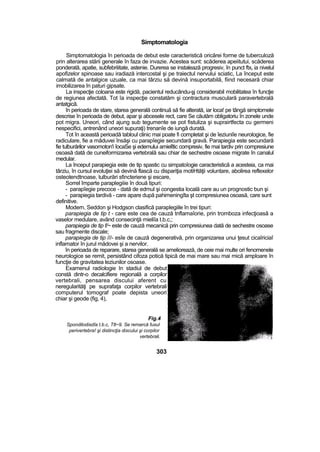 Simptomatologia
Simptomatologia în perioada de debut este caracteristică oricărei forme de tuberculoză
prin alterarea stării generale în faza de invazie. Acestea sunt: scăderea apeiitutui, scăderea
ponderată, apatie, subfebriiitate, astenie. Durerea se instalează progresiv, în punct ftx( ia nivelul
apofizelor spinoase sau iradiază intercostal şi pe traiectul nervului sciatic, La început este
calmată de antalgice uzuale, ca mai târziu să devină insuportabilă, fiind necesară chiar
imobilizarea în paturi gipsate.
La inspecţie coloana este rigidă, pacientul reducându-şj considerabil mobilitatea în funcţie
de regiunea afectată. Tot îa inspecţie constatăm şi contractura musculară paravertebrală
antatgicâ.
în perioada de stare, starea generală continuă să fie alterată, iar loca! pe tângă simptomele
descrise în perioada de debut, apar şi abcesele rect, care Se căutăm obligatoriu în zonele unde
pot migra. Uneori, când ajung sub tegumente se pot fistuliza şi suprairtfecta cu germeni
nespecifici, antrenând uneori supuraţi) trenanîe de iungâ durată.
Tot în această perioadă tabloul clinic mai poate fi completat şi de îeziuniîe neurologice, fie
radiculare, fie a măduvei însăşi cu parapîegie secundară gravă. Parapiegia este secundară
fie tulburărilor vasomoton'i îocaSe şi edemului amielîtic compresiv, fie mai tardiv prin compresiune
osoasă dată de cuneiformizarea vertebrală sau chiar de sechestre osoase migrate în canalul
medular.
La început parapiegia este de tip spastic cu simpatoîogie caracteristică a acesteia, ca mai
târziu, în cursul evoluţiei să devină flască cu dispariţia motiHtăţii voluntare, abolirea reflexelor
osteotendtnoase, tulburări sfincteriene şi escare,
Sorrel împarte paraplegiiie în două tipuri:
- parapîegie precoce - dată de edmul şi congestia locală care au un prognostic bun şi
- parapiegia tardivă - care apare după pahimeningîta şt compresiunea osoasă, care sunt
definitive.
Modern, Seddon şi Hodgson clasifică paraplegiile în trei tipuri:
parapiegia de tip t - care este cea de cauză tnflamaîorie, prin tromboza infecţioasâ a
vaselor medulare, având consecinţă mieliîa t.b.c,;
parapiegia de tip f/~ este de cauză mecanică prin compresiunea dată de sechestre osoase
sau fragmente discale;
parapiegia de tip ///- esîe de cauză degenerativă, prin organizarea unui ţesut cicaîriciaî
inflamator în jurul mădovei şi a nervilor.
în perioada de reparare, starea generală se ameliorează, de ceie mai multe ori fenomenele
neurologice se remit, persistând cifoza potică tipică de mai mare sau mai mică amploare în
funcţie de gravitatea leziunilor osoase.
Examenul radiologie In stadiul de debut
constă dintr-o decalcifiere regională a corpilor
vertebrali, pensarea discului aferent cu
neregularităţi pe suprafaţa corpilor vertebrali
computerul tomograf poate depista uneori
chiar şi geode (fig, 4),
Fig.4
Spondilodisdîa t.b.c, T8~9. Se remarcă fusul
perivertebra! şi distincţia discului şi corpilor
vertebrali.
303
 