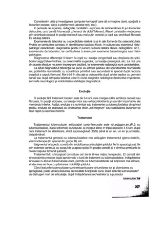 Considerăm utilă şi investigarea computer-tomograf care dă o imagine clară, spaţîafă a
leziunilor osoase, cât şi a părţilor rnoi (abcese reci, etc.).
în perioada de reparare, radiografie constatăm un proces de remineralizare în jurul leziunilor
distructive, ca o bandă întunecată „chenaru! de doliu" Menard, Alteori constatăm vindecarea
prin anchiloză osoasă în poziţie mai mult sau mai puţin corectă (a copil sau anchiloză fibroasă
Ea adulaşi bătrâni.
Examenele de laborator au o specificitate relativă ca şi în aite forme de îbc osteoarticuîară,
Proble ce certitudine constau în identificarea baciiului Koch, în cultura sau examenul histo-
patologic caracteristic. Diagnosticul pozitiv î! punem pe baza datelor clinice, radiogrâfice, C=T,,
examenului de laborator, iar certitudinea o avem prin examene bacierioiogice sau histo-
paioiogice.
Diagnosticul diferenţia! îl facem !a copil cu: luxaţia congenitală sau dispîazia de şold,
boala Legg-Calve-Perthes, cu osieomielîta sugarului, cu luxaţie patologică, etc. La nici una
din aceste afecţiuni nu avem impregnare baciîară, iar exemenele radiologice sunt caracteristice.
La adult diagnosticul diferenţial se pune cu artroza şoldului din spondiîartrita reumatoidă
sau poîiartrita reumatoidă, cu coxartroza primitivă sau secundară în special după necroza
aseptică a capului femural. Mai intră în discuţie şi osteoartrtta după artrite septice cu germeni
banaii sau după artropaiia tabeticâ, care în ciuda imaginilor radiologice destructtve importante,
semnefe neurologice şi indoloritatea stabileşte diagnosticul.
Evoluţie
O evoluţie fără tratament modern este de 3-4 ani, care mergea către anhiîoza osoasă sau
fibroasă, în poziţii vicioase, cu luxaţia intra sau extracotiloidiană şi scurtări importante ale
membrului inferior. Astăzi, evoluţia s-a schimbat sub tratamente cu tubercuîosîatice din primul
stadiu, evoluţia se stopează cu vindecarea chiar „ad integrum" sau stabilizarea leziunilor se
face rapid cu sechele minime.
Tratament
Tratamentul tuberculozei articulaţiei coxo-femurale este rjri.edjggrn.en.tP.S cu
tubercuîostaîice, după schemele cunoscute, la început zilnic în tripia asociere 4-5 luni, după
care tratament de stabilizare, strict supravegheat (TSS) până la un an, un an şi jumătate,
bisăpiămânaî.
La tratamentul general cu tubercuîostatice mai adăugăm tratamentul igieno-dieteîic,
vitaminoterapie (în special din grupul B), etc.
tfalgmentul ortopedic constă din imobilizarea articulaţiei şoldului fie în aparat gipsat, fie
prin extensie continuă, cu scopul de a aşeza şoiduî în poziţie corectă şi a diminua presiunile la
nivelul capului femural şubrezit,
TratamerrtM,! chirurgical constituie ce! de-la lll-iea mijloc terapeutic. E! constă din
sinovectomie precoce după aproximativ o lună de tratament cu tuberculostatice, îndepărtarea
sinoviaiei cu leziuni tuberculoase clare, permite ca tuberculostaticele să acţioneze mai eficace,
vindecarea se face cu păstrarea mobilităţii şoldului.
Când leziunile tuberculoase sunt extraarticuiare chiureîarea ior şi plombarea cu
spongioasă, poate vindeca leziunea, cu rezultate funcţionale bune. Dacă leziunile sunt avansate^
cu distrugeri mari de articulaţie, după îndepărtarea sechestrelor şi a puroiului
 
