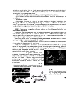 leziunile ce pun în pericol viaţa ca şi cele ce vor prejudicia funcţionalitatea membrelor. După
monitorizarea funcţiilor vitale se va face tratamentul leziunilor locale. Scopul tratamentului
propriu-zis al fracturii este de a realiza:
- reducerea fracturii, deci repunerea fragmentelor în poziţiile lor anatomice;
- imobilizarea - care realizează menţinerea fragmentelor în poziţie de reducere până la
consolidare;
- restaurarea funcţiei,
Reducerea şi imobilizarea fracturilor se poate realiza prin mijloace ortopedice sau
chirurgicale în funcţie de particularităţile fracturii şi aie pacientului. Indiferent de tratamentul
aplicat - ortopedic sau chirurgical - el trebuie totdeauna însoţit de tratamentul de recuperare
funcţionaiă pentru asigurarea restabilirii funcţiei membrului traumatizat.
3.8.2.1. Tratamentul ortopedic realizează reducerea şi imobilizarea fracturilor prin
mijloace nesângerânde.
Reducerea este necesară ori de câte ori există o deplasare a fragmentelor de fractură, în
fracturile fără deplasare, în cele cu deplasare minimă, atunci când restabilirea funcţiei este
posibilă fără o reducere anatomică sau la copiii care au o mare putere de remodelare, mici
deplasări (cu excepţia decalajului) pot fi acceptate.
Reducerea trebuie făcută sub anestezie (locală, regională sau generală) pentru a suprima
durerea şi a obţine o relaxare musculară. Ea poate fi:
. prin manipularea fragmentelor - realizată de obicei sub tracţiune extemporanee
si eventual urmărită pe ecranul de televiziune.
Tracţiunea extemporanee (căreia i se opune o confraextensie realizată de un ajutor),
trebuie să fie progresivă, de durată (câteva minute), urmărindu-se reducerea după refacerea
relaţiei normale dintre reperele anatomice (de exemplu pentru fractura extremităţii disiale a
radiusului se urmăreşte relaţia reciproca dintre
apofiza stiloidă radsală şi cea cubrială);
cu ajutorul extensiei trans-
scheleîice. Extensia poate fi extemporanee (pe masa
ortopedică, de exemplu) urmată de imobilizare
(frg.34), sau poate fi continuă asigurând progresiv
reducerea şi în acelaşi timp imobilizarea până la
stabilizarea focarului şi începutul formării unui calus
unstiv(fig.35).
Fig. 34
Extensie extempor&nee pe masa ortopedică urmată de
imobilizare (aparat ghipsat) pentru o fracttttă de gambă
Fig. 35
Extensie continuă transschetatică
într-o fractură de femur, înainte de
reducere (A) şi după (B)
41
 