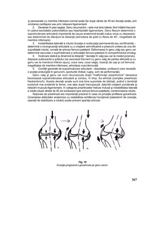 şi persoanele cu membre inferioare normal axate fac după vârsta de 40 ani deviaţii axiale, prin
erodarea cartilajului sau prin relaxare ligamentară.
2. Devierea în pian sagitai, Genu recurvaUim - esîe mai bine tolerat, fiind întâlnit frecvent
In cadrul sechelelor poliomielitice sau hiperlaxitătii ligamentare. Genu flexum determină o
supraîncărcare articulară importantă de cauza anatomică locală (calus vicos cu dezaxare)
sau determinat de afecţiuni la distanţă (artrodeza de şold cu flexie de 45°, inegalitate de
membre inferioare).
3. Instabilitatea laterală a rotuîei (luxatja si subluxaţia permanentă sau recîdîvantă) -
determină o incongruenţă articulară cu o creştere semnificativă a presiunii unitare pe una din
suprafeţele rotuîei, urmată de artroza femuro-patelară. Deformarea în genu valg sau genu var
determină secundar o suprîneărcare a articulaţiei femuro-pateiare hi compartimentul omolog,
4. încărcare statică şi dinamică la distanţă * deviaţia în valg sau var la nivelul piciorului,
dispazia subluxantă a şoldului (se asociază frecvent cu genu valg de partea afectată şi cu
genu var la membrul inferior opus), coxa vara, coxa valga, rezecţii de cap şi col femural,
inegalitatea de membre inferioare, artrodeza coxo-femurală.
5. Condiţii generale de supraîncărcare articulară - obezitatea, profesiuni care necesită
o poziţie prelungită In genunchi, sporturile (fotbal, rugby, schi de performanţă).
Genu valg şt genu var sunt recunoscute drept "malformaţii preartrozîce" deoarece
favorizează supraîncărcarea articulară şi conduc, în timp, Ea artroză (complex preartrozic
Hackenbroch). Aceste deviaţii axiale sunt mai bine suportate de bărbaţi, având o tendinţă
evolutivă mai evidentă la femei, mai ales după menopauză, datorită creşterii ponderale şi
relaxării musculo-ligarnentare. în categoria preartrozelor trebuie inclusă şi instabilitatea laterală
a rotulei (după vârstei de 40 ani evoluează spre artroza femuro-patelară), condromaiacia rotuîei,
No|iunea de preartroză are importanţă practică în ceea ce priveşte profilaxia gonartrozei.
Corectarea defectelor anatomice cu restabilirea echilibrului funcţional {osteotomiî de corecţie,
operaţii de stabilizare a rotulei) poate preveni apariţia artrozei.
Fig. 10
Evoluţia progresivă a gonartrozei pe genu varum
367
 