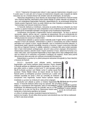 3.8.2.2. Tratamentul chirurgical este indicat în căzui eşecului tratamentului ortopedic ca şi l
în acele cazuri în care ştim de !a început că tratamentul ortopedic este incapabil să obţină
reducerea sau să o menţină (fracturi ale ambelor oase ale antebraţului, de exemplu).
Reducerea sângerândă {cu focar deschis) are dezavantajul că transformă o fractură închisă
îrrfr-o fractură deschisă, deschizând uneori poarta infecţiei (în pofida măsurilor de asepsie), în
plus, prin evidenţierea fragmentelor fracturare, deperiostarea lor, ea accentuează devascula-
rizarea acestor fragmente, factor ce poate întârzia sau chiar împiedica consolidarea. Ea are
însă avantajul unei reduceri anatomice a fracturii.
în fracturile diafizare şi meîafizare, reducerea se poate efectua şi ortopedic {cu focar
Tnchts) cu ajutorul tracţiunii pe masa ortopedică si sub urmărirea ecranului de televiziune,
urmând să fie încredinţată metodelor chirurgicale numai imobilizarea fragmentelor.
Imobilizarea chirurgicală a fragmentelor fracturiî-osteosinteză - se face cu ajutorul
şuruburilor, plăcilor, sârmei, tijei etc., materiale de osteosinteză. Ele sunt confecţionate din
oţeluri ausîenice, titanrum sau aliaje de titaniu, materiale bine tolerate de organism si care nu
suferă procese de coroziune în mediul intern.
Osteosinteza realizată cu ajutorul acestor materiale poate fi rigidă, fermă, suprimând orice
mişcare în focar {de exemplu, osteosinteză cu placă cu compactare) sau poate fi elastică
permiţând micr mişcări în focar, mişcări tolerabile, care nu împiedică formarea căluşului, în
osteosinteză rigidă, datorită neutralităţii mecanice a focarului, mugurii conjunctivo-vasculari
trec dintr-un fragment fracturar în celălalt, realizând o vindecare fără calus evident periostal,
fără o fază intermediară cartilaginoasâ, denumit calus primar angiogen (Krompecher).
Osteosinteza elastică, datorită micilor mişcări existente în focar, determină formarea unui
calus unitjv mare, care înconjoară fragmentele şi trece iniţial printr-o fază carfjlaginoasâ care,
apoi se osifică (ca în osificarea «ncondrală a cartilajului de creştere). Acest calus poartă
denumirea de calus secundar prin osîficare encondrală (Krompecher).
Osteosinteza cu şuruburi şi cu pfacă presupune reducerea chirurgicală (cu focar deschis)
a focarului de fractură.
3,8.2.2.1. Şuruburile sunt utilizate pentru menţinerea
fragmentelor unei fracturi epifizare (după reducere). Pentru aceasta
în fracturile eprfizare se utilizează şuruburi de spongie, cu filet rar şi un
pas adânc pentru a realiza o priză bună Tn osul spongios epifizar
(fig,39 b).Aceste şuruburi sunt filetate numai în partea opusă florii
şurubului. Partea filetată trebuie să treacă dincolo de focarul de
fractură pentru ca strângerea şurubului (eventual pe o şaibă care
măreşte suprafaţa de sprijin a florii pe corticalâ) să realizeze o
compactare între fragmente). Aceste fracturi epifizare reduse si
imobilizate cu şuruburi se vindecă prin calus primar angiogen.
Şuruburile sunt utilizate şi pentru a menţine fragmentele
reduse, în fracturile diafizare oblice lungi sau sptroide. Ele pot
realiza şi o compresiune între fragmente, ceea ce îmbunătăţeşte
imobilizarea. Se utilizează şuruburi de corticală, care au un filet
putjn adânc şi cu pas mic (fig.39 a). Reducerea fracturii este
menţinută cu instrumente speciale şi se forează
un orificiu în ambele corticale, traversând traectul de fractură cu
ajutorul unui burghiu. Se pot utiliza direct şuruburi auto-tarodante sau mai întâi se realizează
un filet în ceie două corticale
43
Fig. 39 Diferite tipuri de şuruburi
(după D. Dantty):
a, şurub de corticaiă; b. şurub de
spongie;c.şurubpentru fracturile
scafoidului; d. şurub maleotar;
e. şurub de corticală auto-
tarodant
 