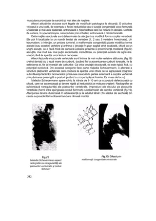 Elemente de ortopedie si traumatologie