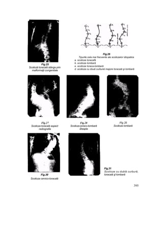 Elemente de ortopedie si traumatologie