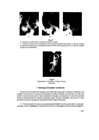 Elemente de ortopedie si traumatologie