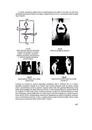 Elemente de ortopedie si traumatologie