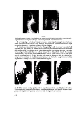 Elemente de ortopedie si traumatologie