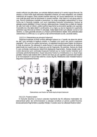 nivelul orrficiului de pătrundere, pe corticala diafizară externă şi în centrul capului femural. Se
introduc cu focar închis după reducerea ortopedică a fracturii, pe masa ortopedică, sub controlul
întăritorului de imagine. Dacă canalul medular este larg, din cauza osteoporozei, se introduc
mai multe tije până când se blochează în canalul medular, chiar dacă nu mai ajung până în
cap. Permit mobilizarea imediată a pacientului. Au toate avantajele osteosintezei cu focar
închis dar în fracturile instabile, cum sunt majoritatea fracturilor trohanteriene, fractura îşi
găseşte propria stabilitate în timpul mersului, telescopanduse. Aceasta face ca tijele să migreze
de cele rnai multe ori inferior, putând perfora tegumentul şi provocând apariţia unei supuraţi),
încercările de a fixa tijele distal în condil pentru a nu migra, au dus la migrarea lor superioară,
perforând capul femural şî intrând în articulaţie. Astăzi tijele Ender sunt utilizate numai la rnari
vârstnici, cu stare generală precară şi cu fracturi pertrohanteriene stabile. Este preferată astăzi
osteosinteza cu DHS sau cu cui gama (o tijă centromedulară scurtă, zavarată static).
3,8,2.2,4, Osteosinteza pe principiul hobanuluî
Dicţionarul explicativ al limbii române defineşte hobanul ca o "coardă, de obicei din sârmă
de oţel, care serveşte la legătura aripilor cu fuselajul unui avion sau pentru susţinerea
catargelor". Din punct de vedere biomecanic, el realizează transformarea forţelor de tracţiune
în forţe de presiune. Se utilizează în acele fracturi în care există forţe puternice de tracţiune
determinate de muşchii care se însera pe unul din fragmente. De exemplu, fractura de rotulă
în care contracţia cvadricepsului determină deplasarea fragmentelor. Aceiaşi situaţie este ta
nivelul olecranului (prin contracţia tricepsuluî brahial) sau ia nivelul marelui trotianter (prin
contracţia pelvitrohanterienilor). După reducerea fracturii şi imobilizarea ei cu două broşe
paralele, hobanul este alcătuit dintr-o sârmă care trece pe sub capetele superioare ale broşelor
şi se încrucişează în opt pe faţa externă a osului (fig.58). Mobilizarea este imediată hobanu!
asigurând compactarea fracturii.
Fig, S8
Osteosinteza unei fracturi de rotulă după principiul babanului
3.8.2.2.5. Fixatorul extern
în fracturile deschise cu leziuni cutanate importante (tip III) utilizarea materialelor de
osteosinteză (plăci, tije centromedulare cu alezaje) constituie un pericol, putând favoriza
devascularizarea fragmentelor şi apariţia infecţiei, în aceste cazuri se utilizează fixatorul extern
 