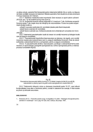 un ghips ocluzie, pacientul fiind transportat pentru tratamentul definitiv într-un centru ce dispune
de toate condiţiile necesare de tratament. Metoda spaniolă a fost reluată de armata americană
în timpul războiului din Vietnam.
3.9.1.7. Stabilirea metabolică este importantă. Este necesar un aport caloric suficient
(40 kcal. sau 1 gr de proteine pe kg corp şi pe zi).
3.9.1.8. Acoperirea focarului trebuie asigurată în 3 maximum 7 zile. Amânarea acoperirii
focarului peste 7 zile creşte riscul de infecţie şi de neconsolidare. Focarul se poate acoperi
după situaţia locală cu:
- pSastiî musculare pediculaie din vecinătate+plastie piele liberă despicată;
- plastii fascio-cutanaie din vecinătate;
- plastii fascio-cutanate sau miofasciocutanate de la distanţă prin procedee de micro-
chîrurgie,
3.9.2. Tratamentul pseudartrozelor caută să creeze noi condiţii mecanice şi biologice locale
care să asigure consolidare,
3.9.2.1. Pseudartrozele hipertrofice-hipervasculare se datoresc, de regulă, unor condiţii
mecanice neadecvate (osteosînteze care nu asigură stabilitatea focarului). Este de obicei
suficientă o osteosinteză fermă cu compactare, pentru a asigura consolidarea.
3.9.2.2, în pseudartrozele atrofice, hipovascylare, pe lângă o osteosinteză ferma este
necesar un aport biologic (autogrefa spongioasă sau cortîco spongioasă) pentru a relansa
procesul consolidării (fig.62).
Fig. $2
Pseudartroza hipovasculară diafîza hurnerus în 1/3 distaiă, imagine de fată (A) şi profil (B),
osteosinteză cu placă şi aport de grefă cortico-spongtoasă din creasta iliacă (C)
3.9,3. Tratamentul căluşului vicios cu dezaxare importantă peste 10-15°, care tulbură
funcţionalitatea (mas ales a membrului pelvin), constă în osteotomii de corecţie, în felul acesta
se previn şi artrozele secundare.
BIBLIOGRAFIE
1, Antonescu M. D. - Fracturile oaselor lungi, în Angel&scu N. editor - Patologia chirurgicală pentru
admitere în rezidenţial - voi.II, pag.181-220, Edii. Celsius, Bucureşti, 1997,
54
 
