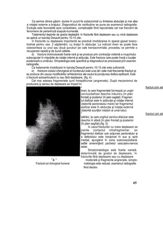 Ca semne clinice găsim: durere în punct fix subacromial cu limitarea abducţiei şi mai ales
a rotaţiei externe a braţului. Diagnosticul de certitudine se pune pe examenul radiografie.
Evoluţia este favorabilă spre consolidare, complicaţiile fiind reprzentate cel mai frecvent de
fenomene de periartrozâ scapulo-humerală.
Tratamentul depinde de gradul deplasării. In fracturile fără deplasare sau cu mică deplasare
se aplică un bandaj Desault pentru 10-15 zile.
în fracturile cu deplasare importantă se practică imobilizarea In aparat gipsat toraco-
brahial pentru cea. 3 săptămâni, cu braţul în abducţie. La indivizii tineri se poate face
osieosinteza cu unul sau două şuruburi pe cale transacromîală, procedeu ce permite o
recuperare rapidă şi de bună calitate.
d) fractura trohinutuieste foarte rară şi se produce prin contracţia violentă a muşchiului
subscapular în mişcările de rotaţie internă şi adducţie. Este fractura care poate însoţi o luxaţie
posterioară a umărului. Sîmpatologia este specifică şi diagnosticul se precizează prin examen
radiografie,
Ca tratamente imobilizare In bandaj Desault pentru 10-15 zile este suficientă.
e) fractura colului chirurgical al hunterului esle una din cele mat frecvente fracturi şi
se produce din cauza modificărilor arhitectonice ale osului la joncţiunea diafizo-epifizară. Este
o fractură extraarticulară cu sau fără deplasare, {fig, 4)
Cel mai adesea fragmentele sunt întrepătrunse (angrenate). După mecanismul de
producere şi sensui de deplasare se împart în:
• fracturi prin add
tineri, la care fragmentele formează un unghi
cervicodiafizar deschis înăuntru (în plan
frontal) şi posterior (în plan sagital). Fragmen
tul diafizar este în adducţie şi rotaţie internă
(datorită pectoralului mare) tar fragmentul
epifizar este în abducţie şi rotaţie externă
(datorită scurţilor rotatori ai umă-rylui).
* fracturi pin ab
bătrâni, Ia care unghiul cervîco-dîaUzar este
deschis în afară (în plan frontal) şi posterior
(în plan sagîtal),(fig. 5)
în cazul fracturilor cu mare deplasare se
pierde contactul intrafragmentar, iar
fragmentul diafizar sub acţiunea pectoralului şi
a deltoidului este tracţionat In sus şi spre
medial, ajungând în zona subcoracoidîanâ,
astfel ameninţând pachetul vascularo-nervos
axiiar.
Simptomatologia este foarte variată,
determinată de gradul de deplasare, în
fracturile fără deplasare sau cu deplasare
F
& 4
moderată şi fragmente angrenate, simpto-
Fractură col chirurgical humerai matoiogia este redusă, examenul radiografie
fiind decisiv.
65
 